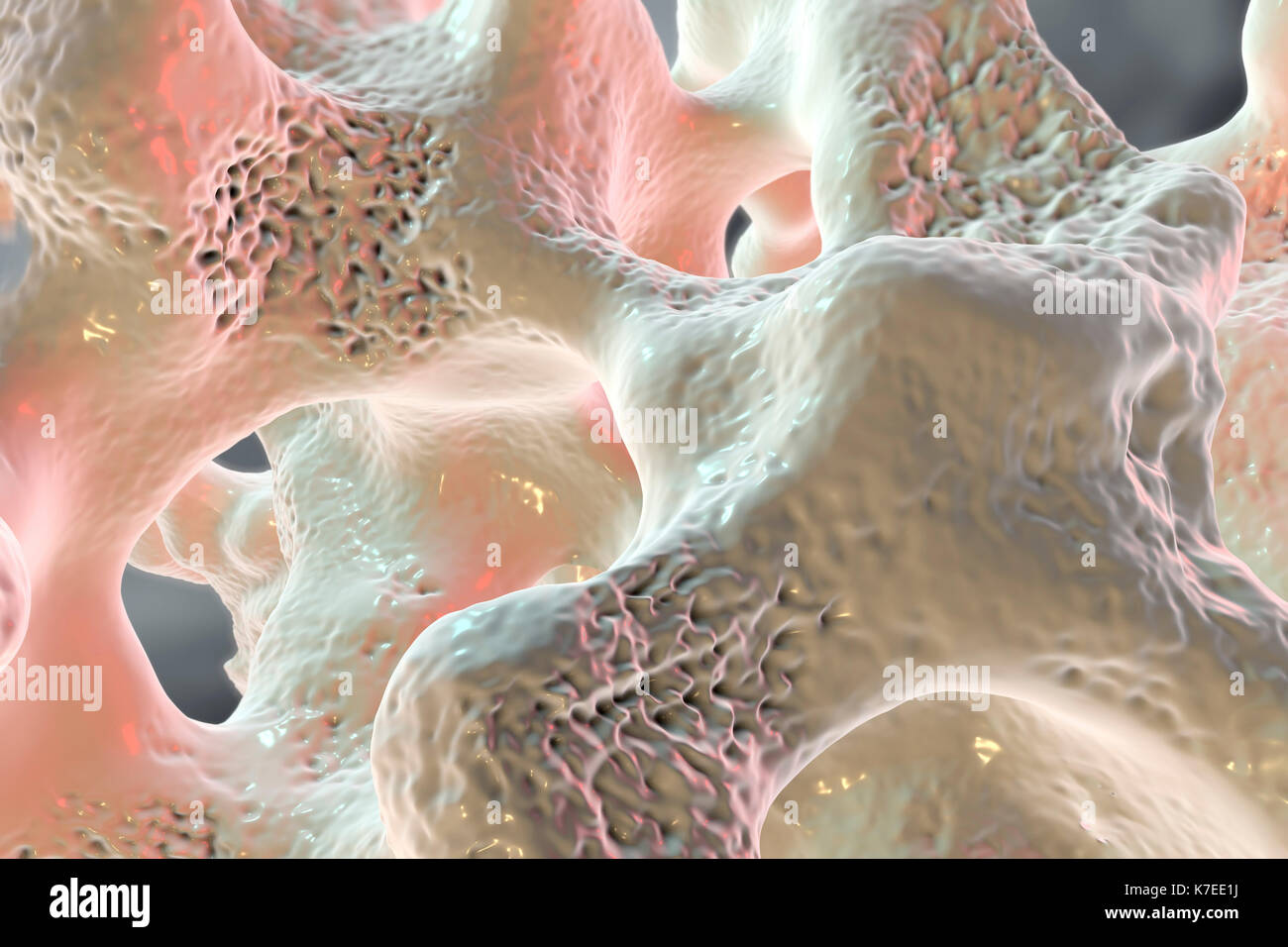 Osteoporosis bone matrix hi-res stock photography and images - Alamy