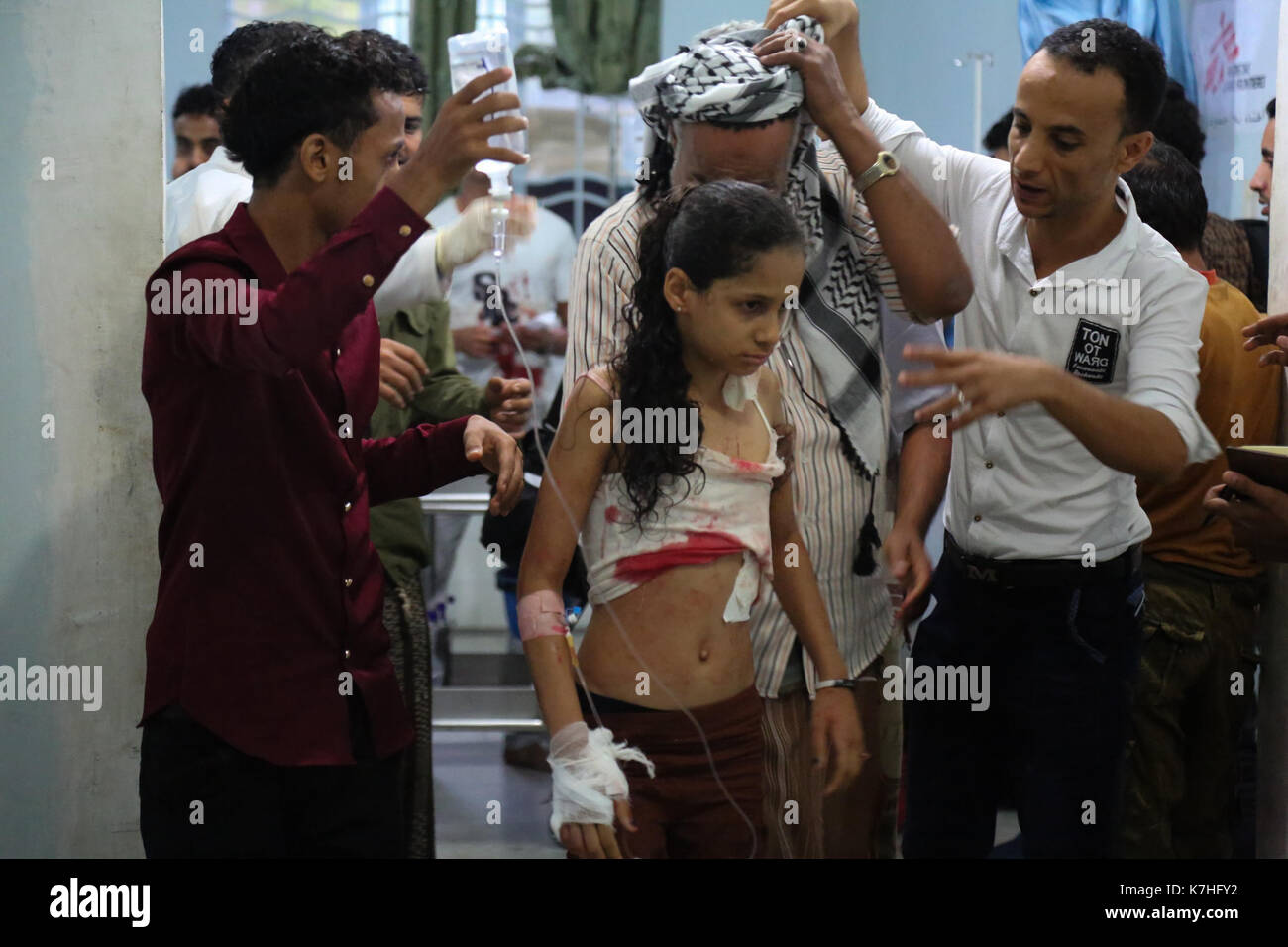 Civilians are treated in the Revolution hospital in the centre of Taiz for various injuries, following artillery shelling in residential neighbourhoods of the Yemeni city. 15th Sep, 2017. The bombardment was carried out by the Ansar Allah movement (Houthi) and their allied forces loyal to former Yemeni president Ali Abdullah Salih. Three missiles targeted the neighbourhoods of Shab Dima, of the Al-Sameel market, and of Jiula Al-Haud, located in the west of Taiz, killing three children and injuring ten civilians Credit: Abdulnaser Alseddik/ImagesLive/ZUMA Wire/Alamy Live News Stock Photo