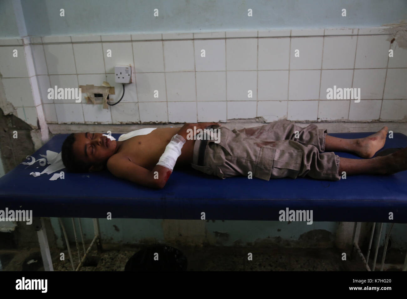 Civilians are treated in the Revolution hospital in the centre of Taiz for various injuries, following artillery shelling in residential neighbourhoods of the Yemeni city. 15th Sep, 2017. The bombardment was carried out by the Ansar Allah movement (Houthi) and their allied forces loyal to former Yemeni president Ali Abdullah Salih. Three missiles targeted the neighbourhoods of Shab Dima, of the Al-Sameel market, and of Jiula Al-Haud, located in the west of Taiz, killing three children and injuring ten civilians Credit: Abdulnaser Alseddik/ImagesLive/ZUMA Wire/Alamy Live News Stock Photo