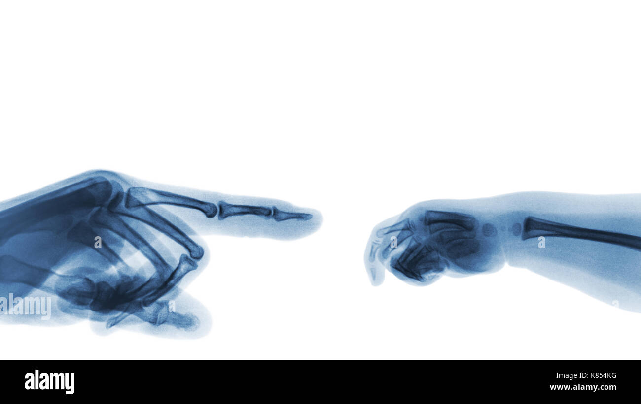 X-ray adult's hand point finger at left side and baby's hand at right side. Blank area at upper side . Stock Photo