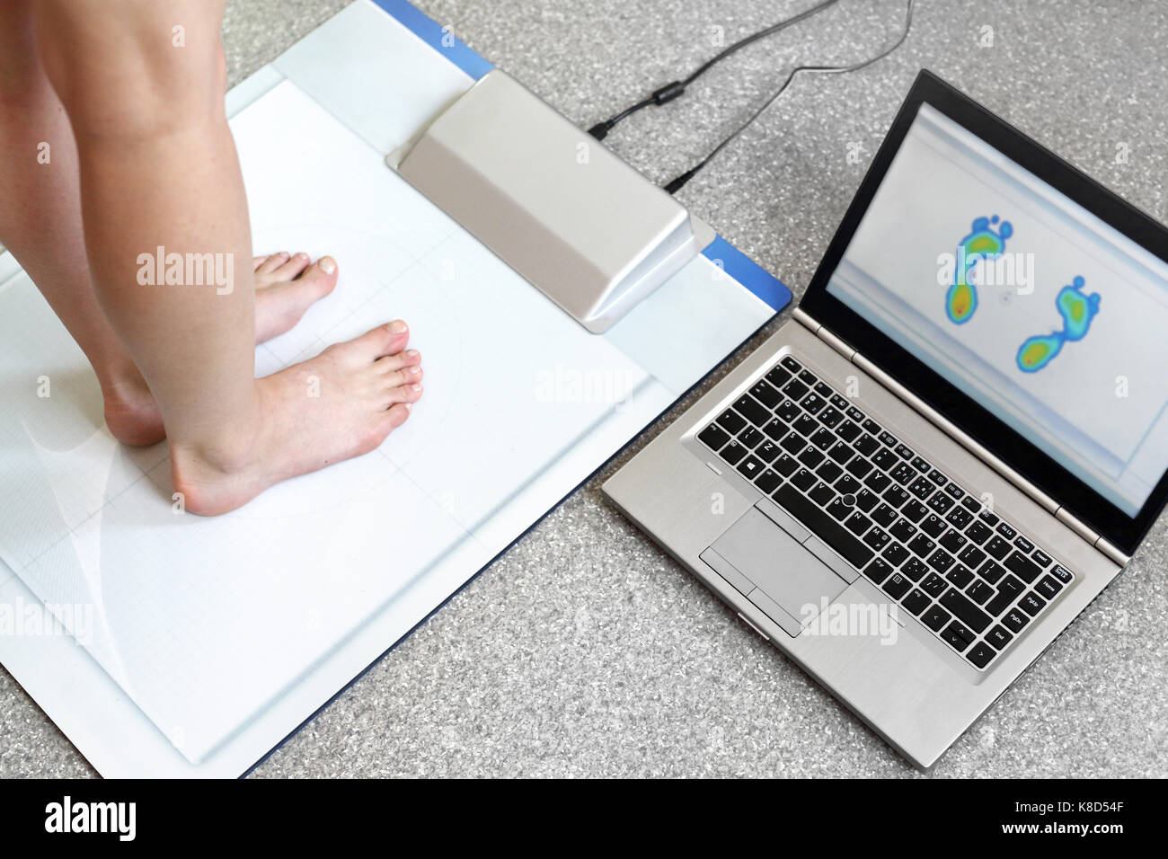 Platypus, orthopedic woman. Female feet during a podoscopic examination in an orthopedic surgery. Stock Photo