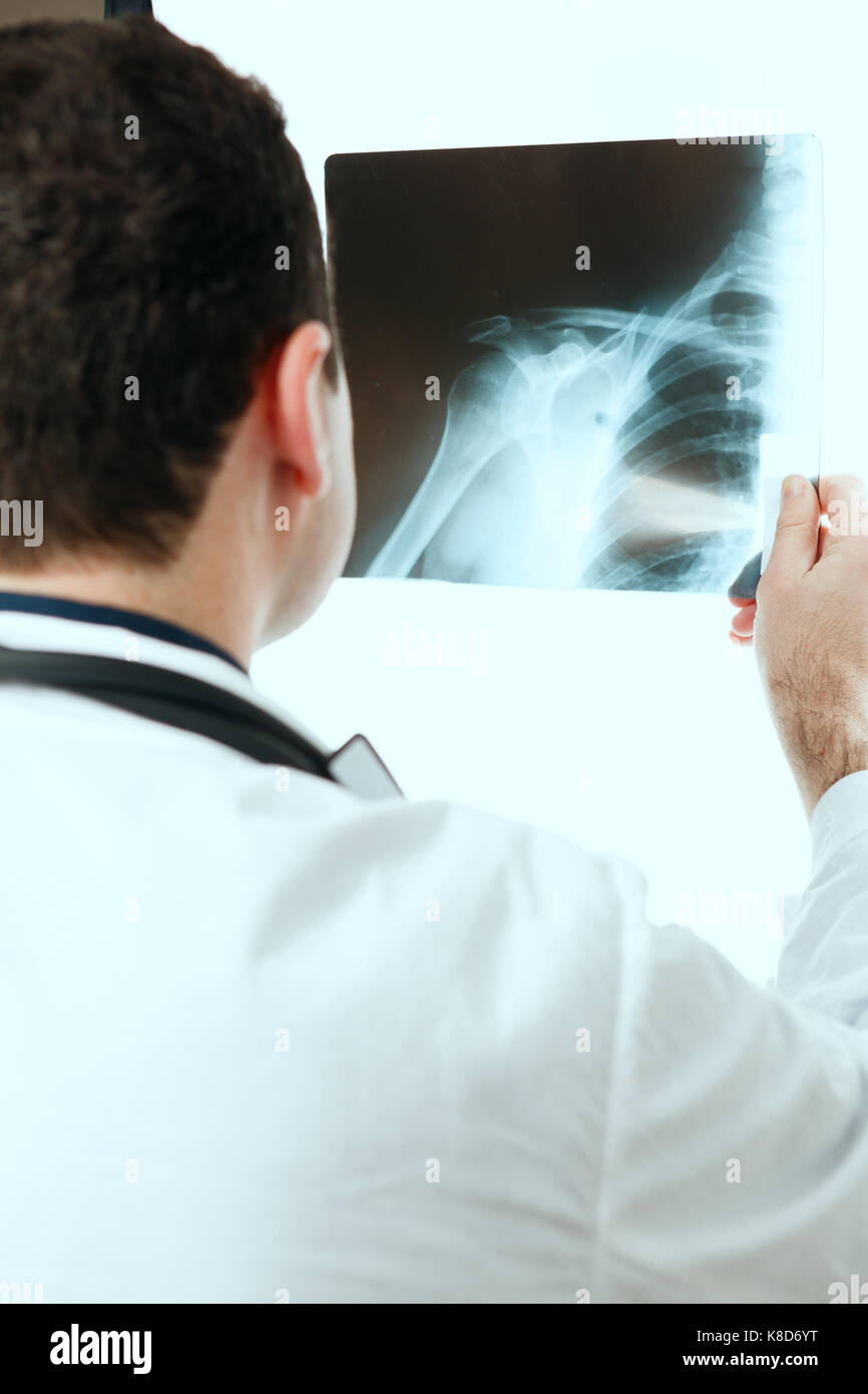 Looking at chest x ray hi-res stock photography and images - Alamy