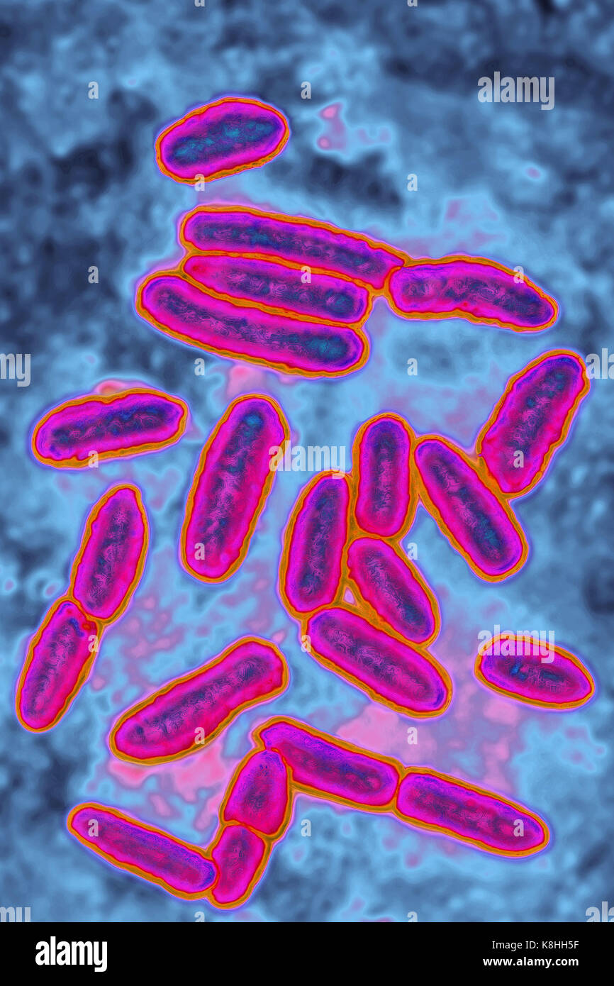 PSEUDOMONAS AERUGINOSA Stock Photo