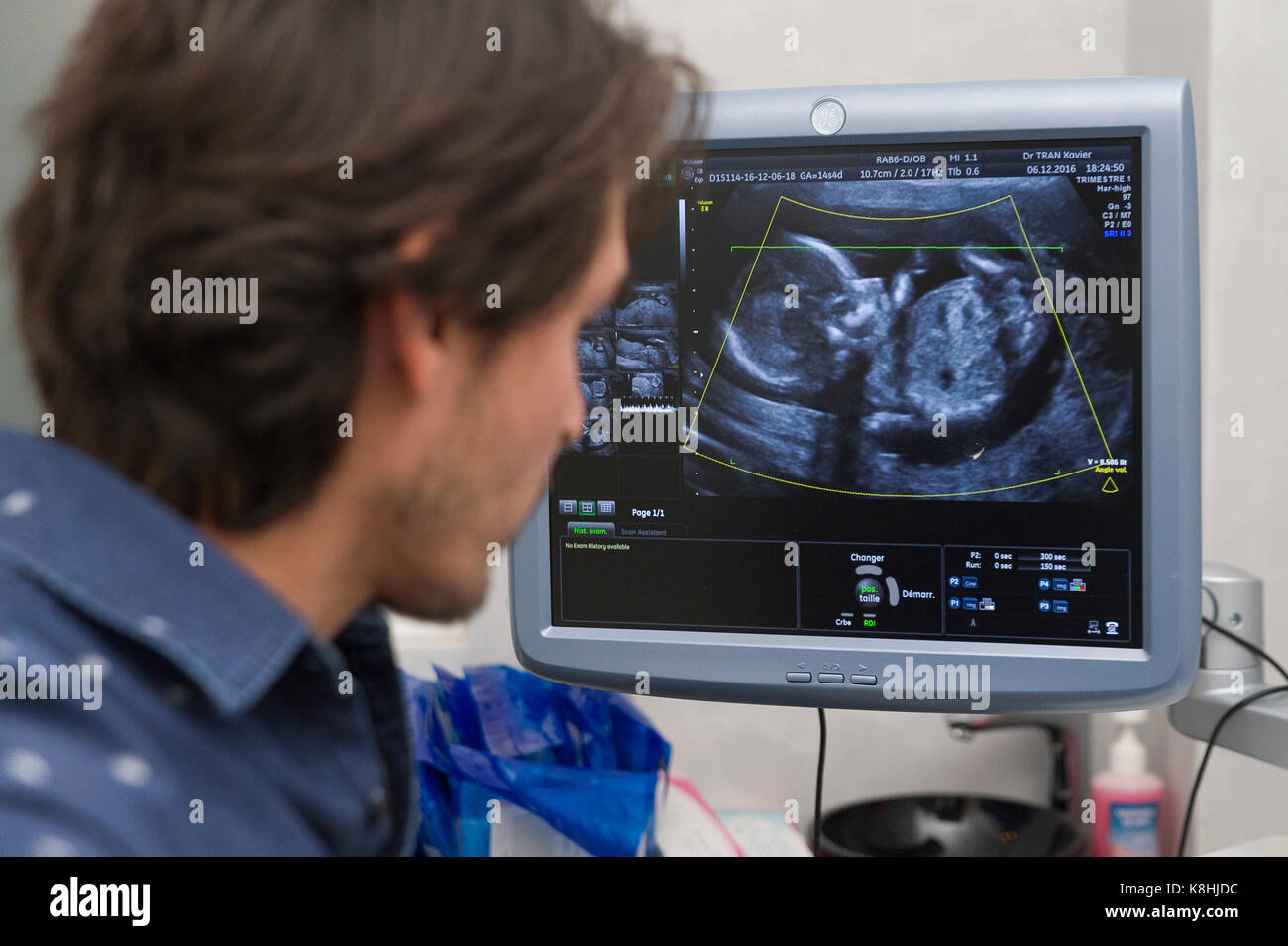 PREGNANT WOMAN, ULTRASOUND Stock Photo