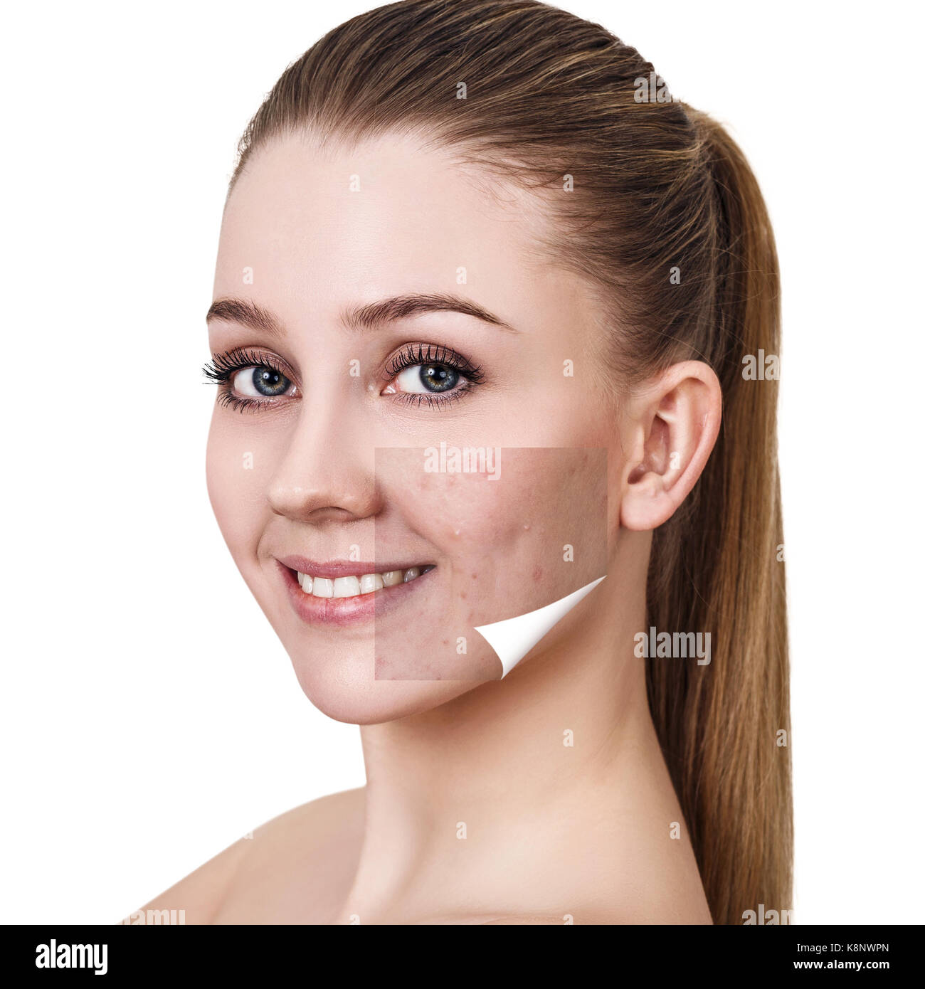 Before after face hires stock photography and images Alamy