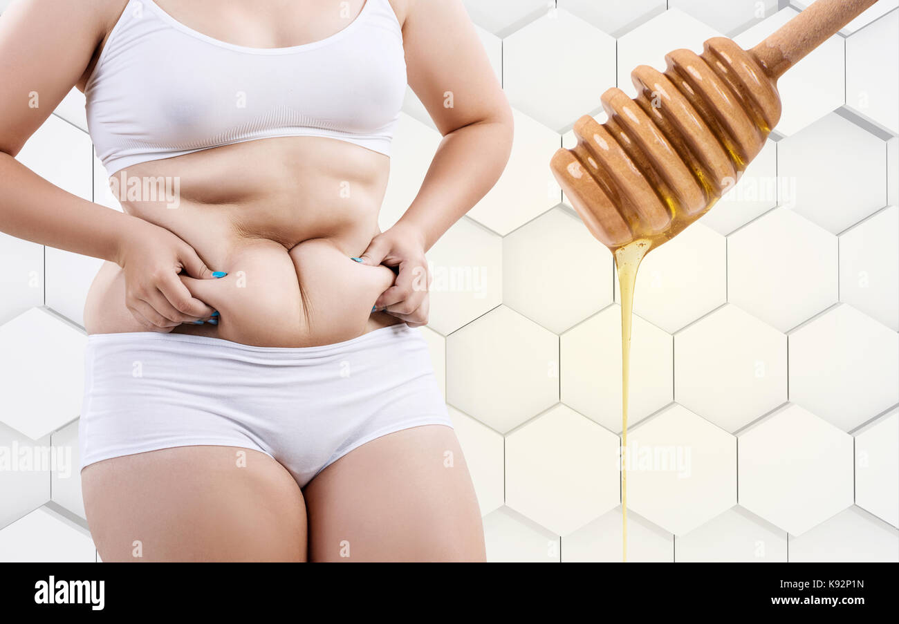 Fat woman preparing for honey massage. Stock Photo