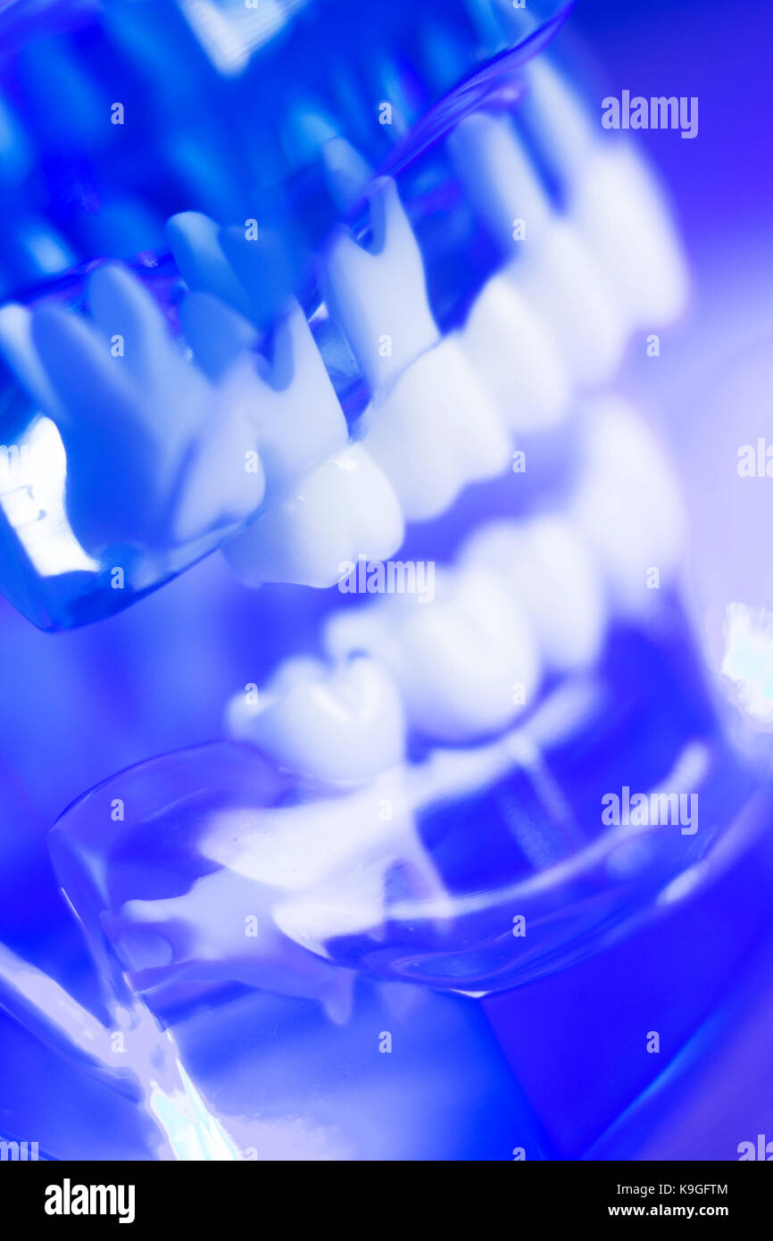 Dental teeth orthodontic dentistry teachng model with gums, tooth