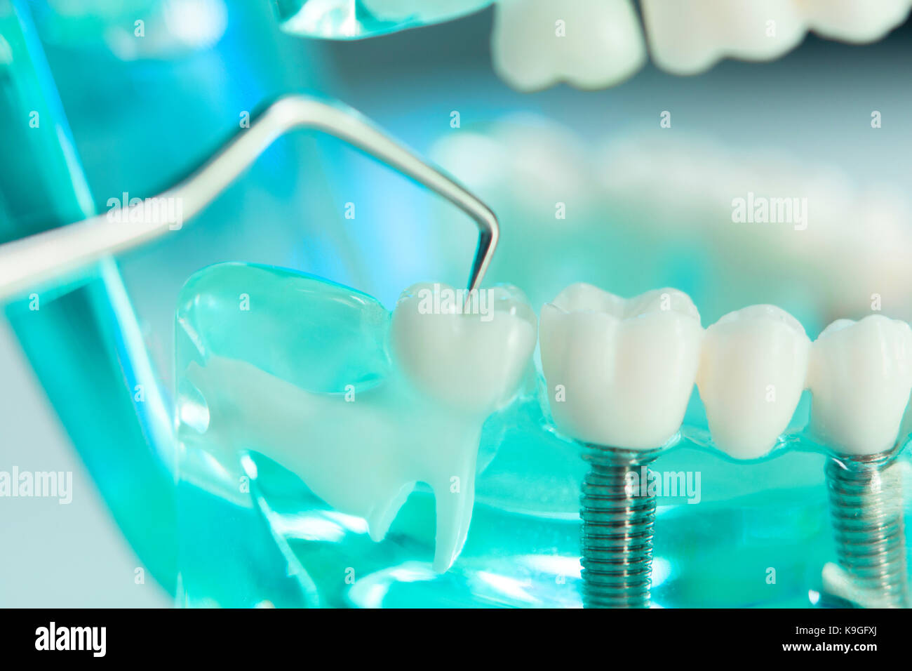 Dental teeth, mouth, gums dentists teaching model showing each tooth ...