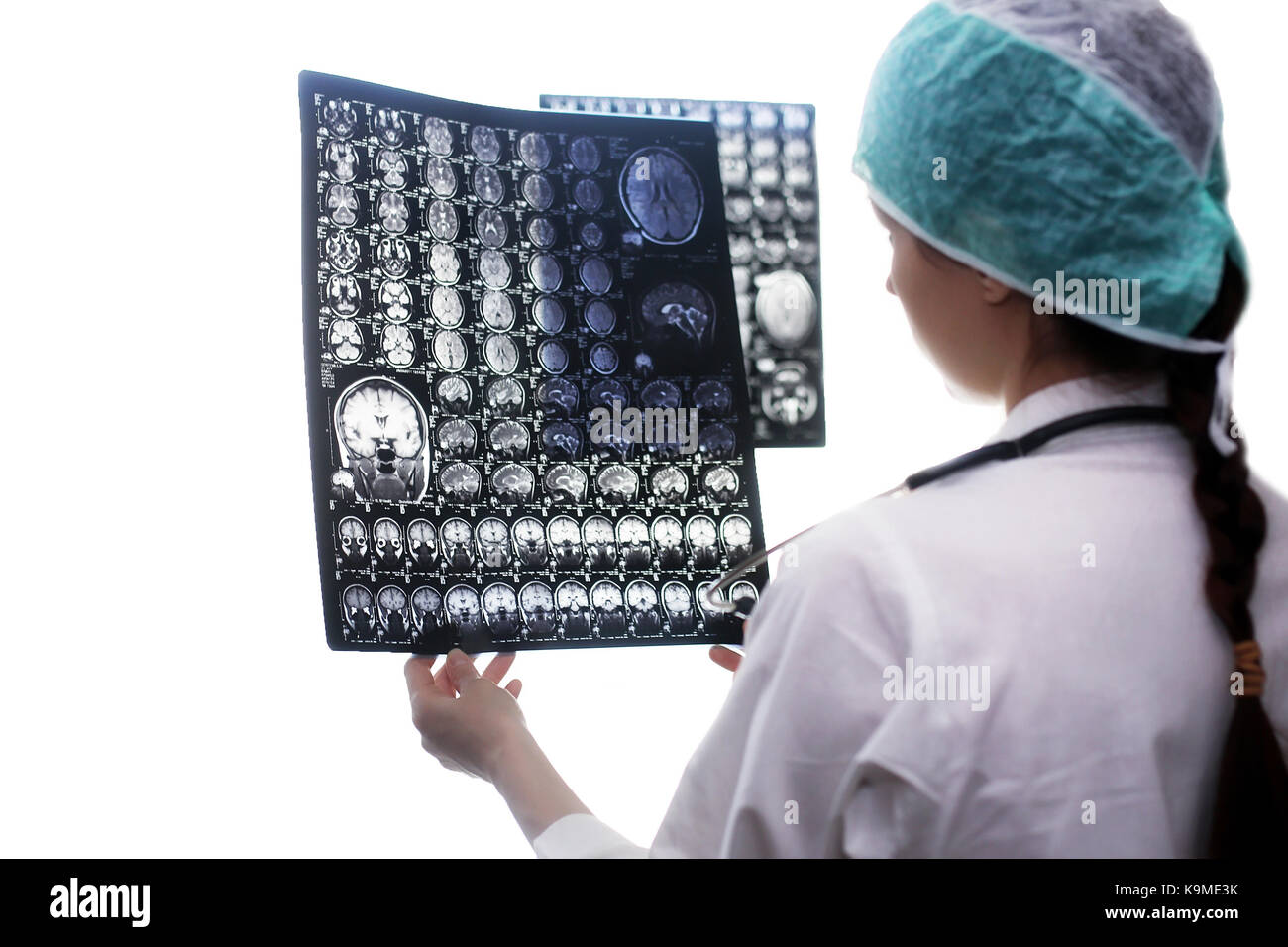 Doctor holding a picture of a brain MRI Stock Photo - Alamy