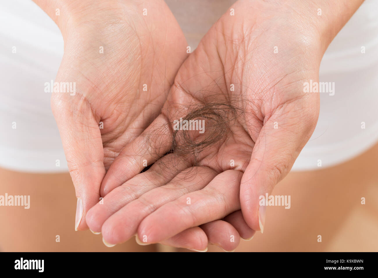 Close-up Of Person Hand Holding Loss Hair Stock Photo