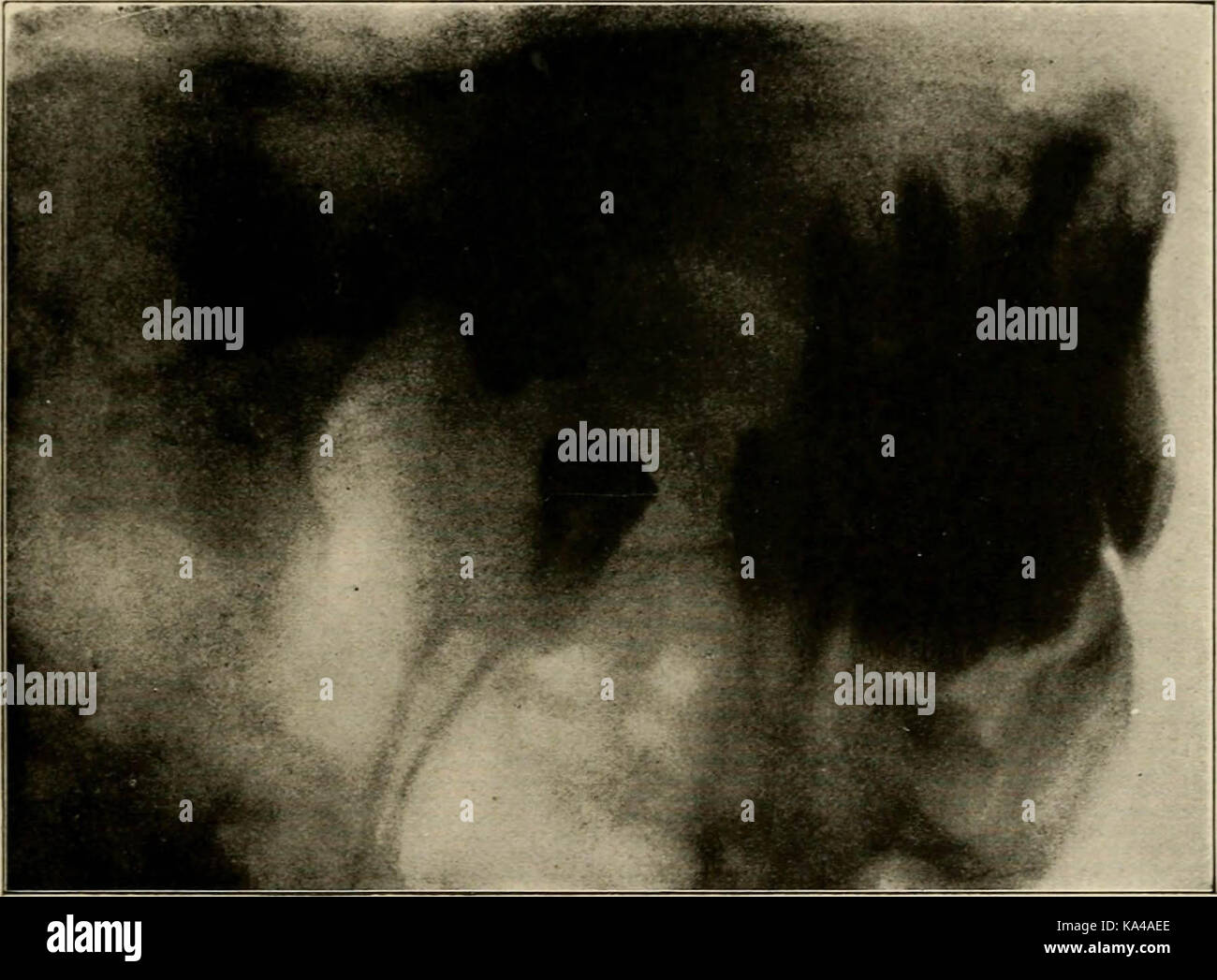 Radiography historical hires stock photography and images Alamy