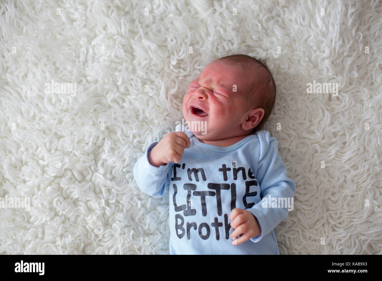 Little newborn baby crying, baby with skin rash, child dermatitis