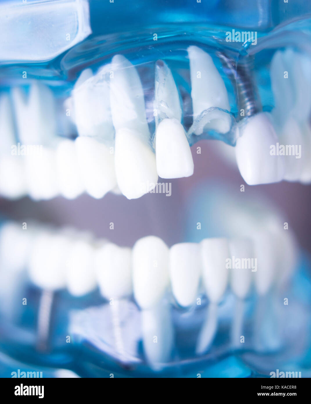 Dentsts dental prosthetic teeth, gums, roots teaching student model