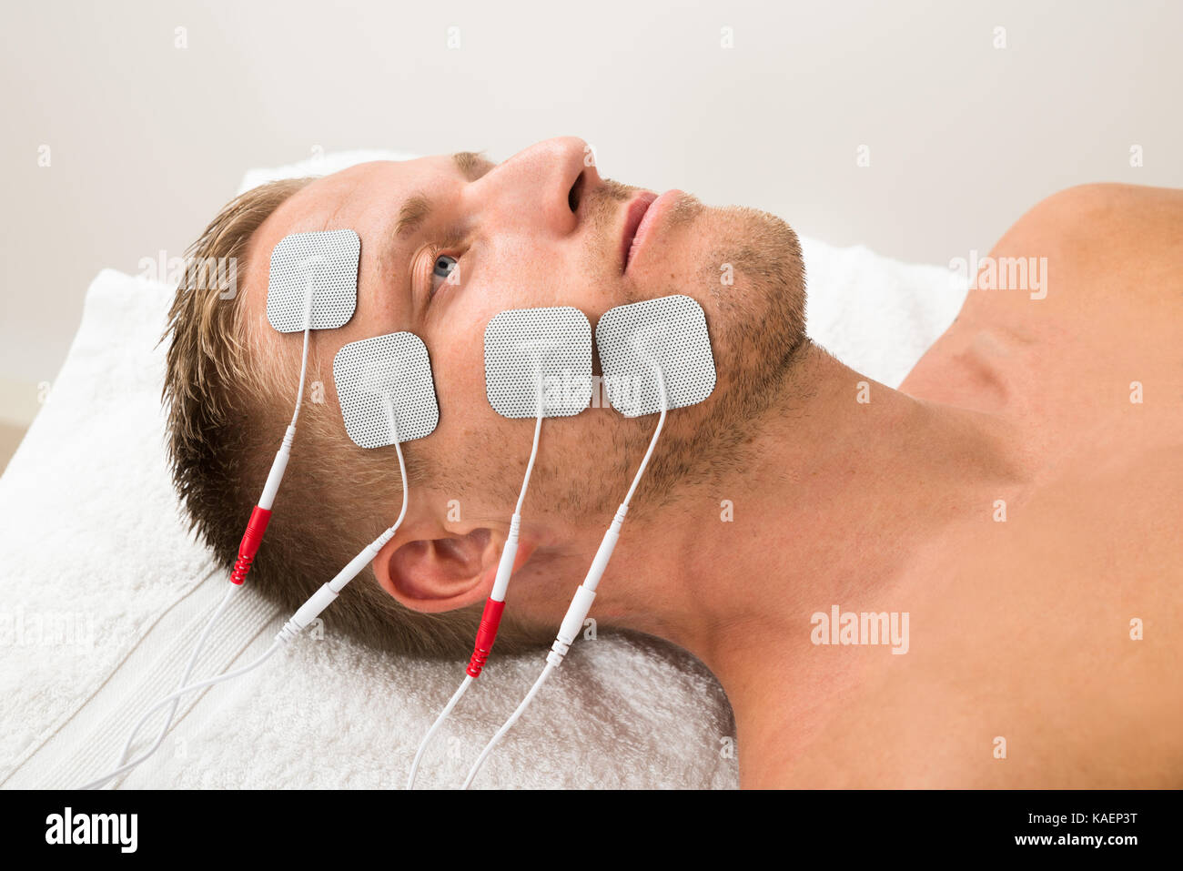 Tens Electrode Placement For Bell's Palsy mogcsp.gov.lr