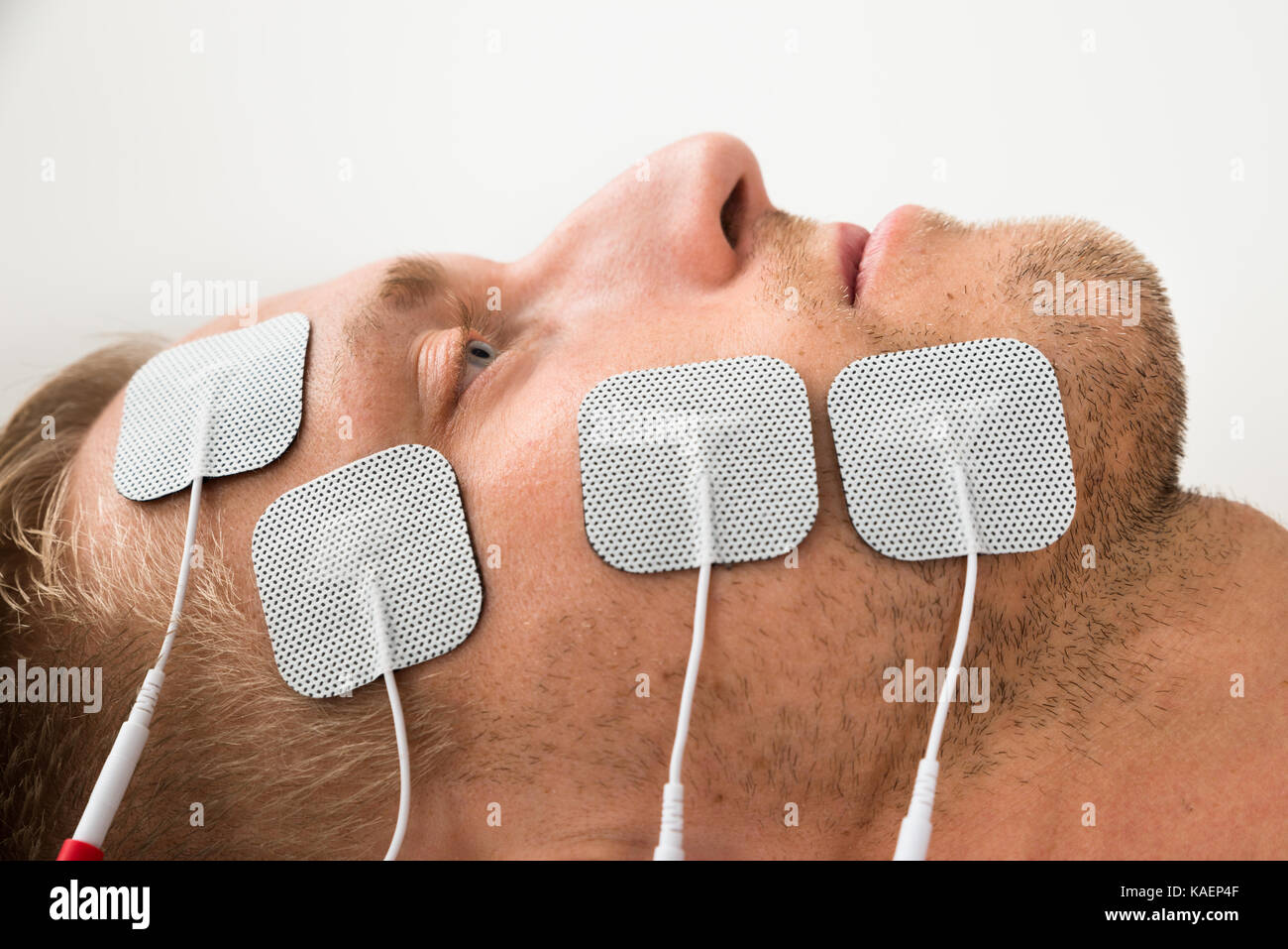 Closeup Of Young Man With Electrodes On Face Stock Photo Alamy