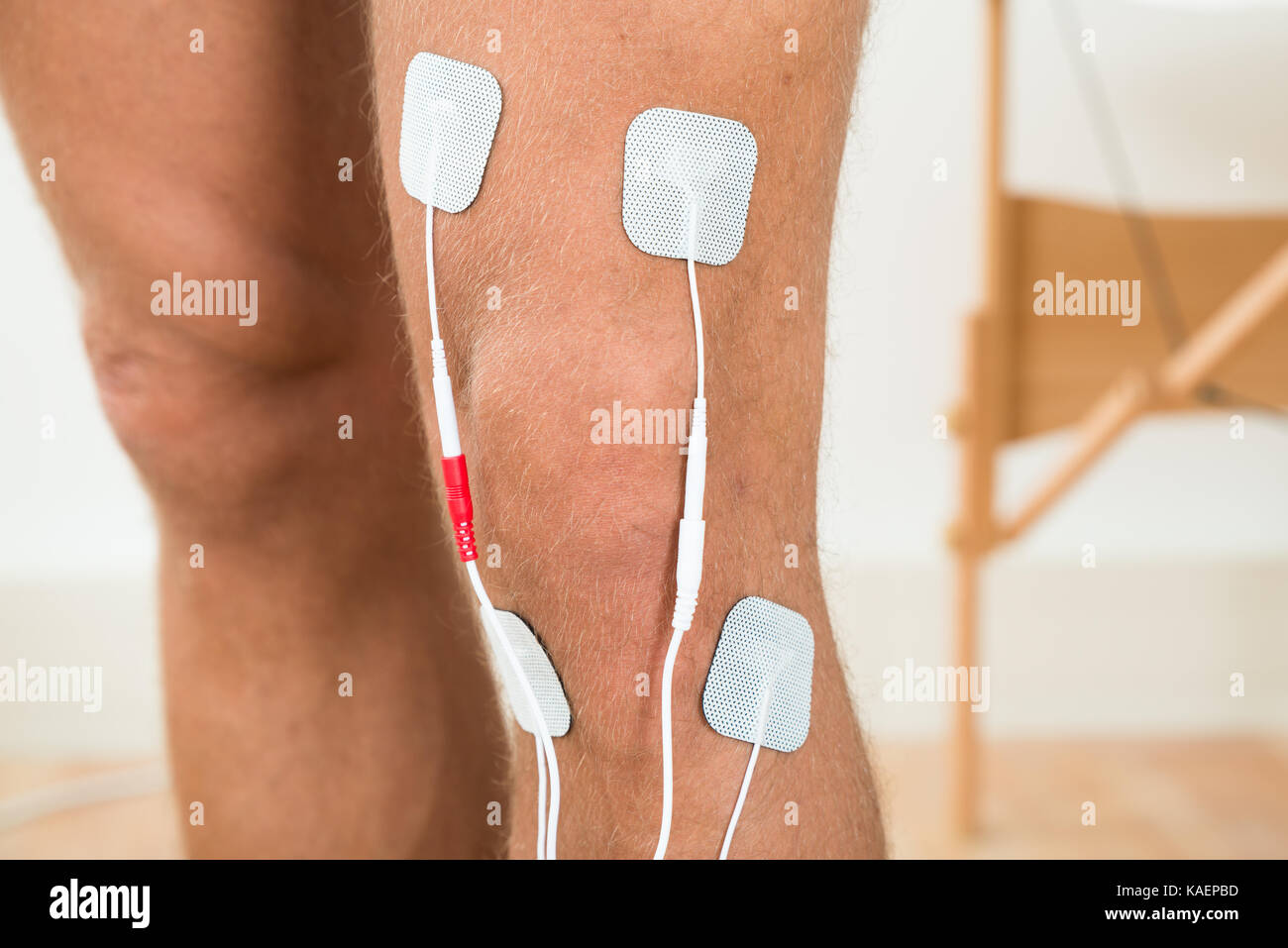 Closeup Of Person Legs With Electrostimulator Electrodes On Knee Stock