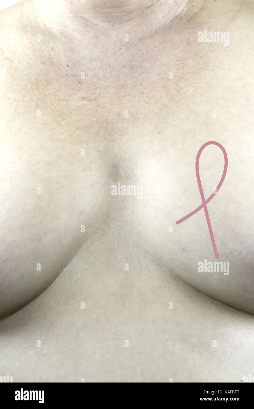 mature nipple Breast Cancer Awareness pink ribbon on bare breasts of mature woman Stock  Photo - Alamy