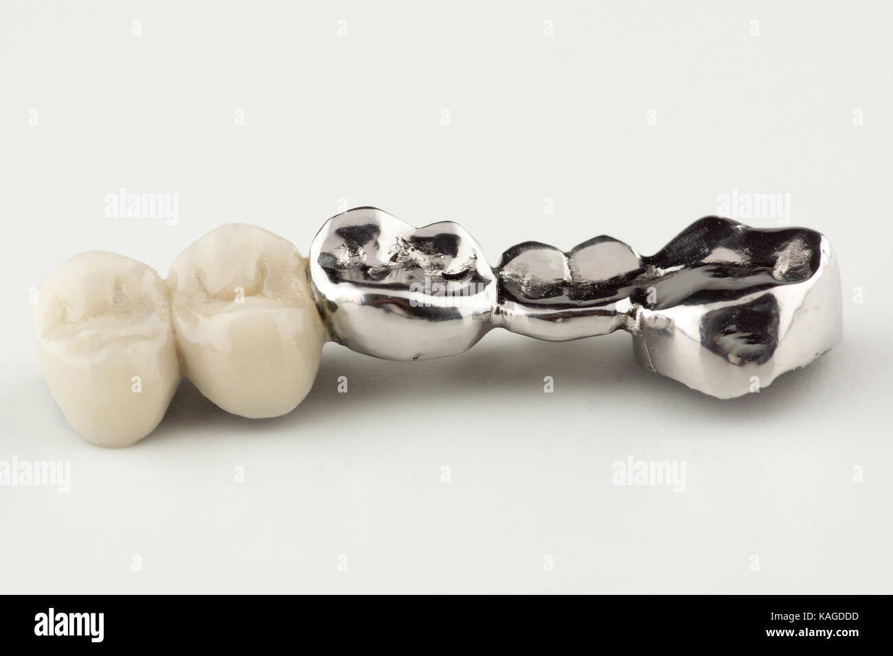 Bridged dental prostheses are made of steel and ceramic paste Stock Photo