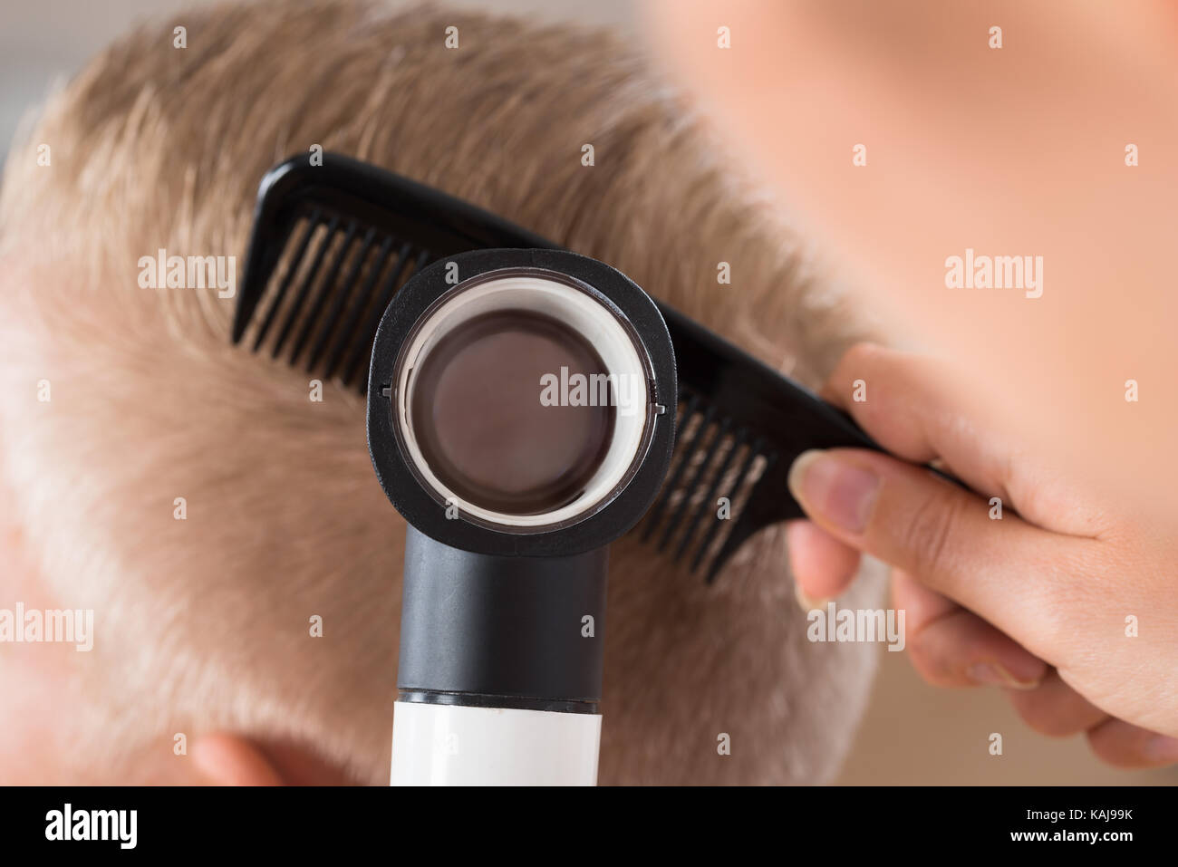 Close-up Of A Doctor Examining Patient's Hair Through Dermatoscope Over White Background Stock Photo