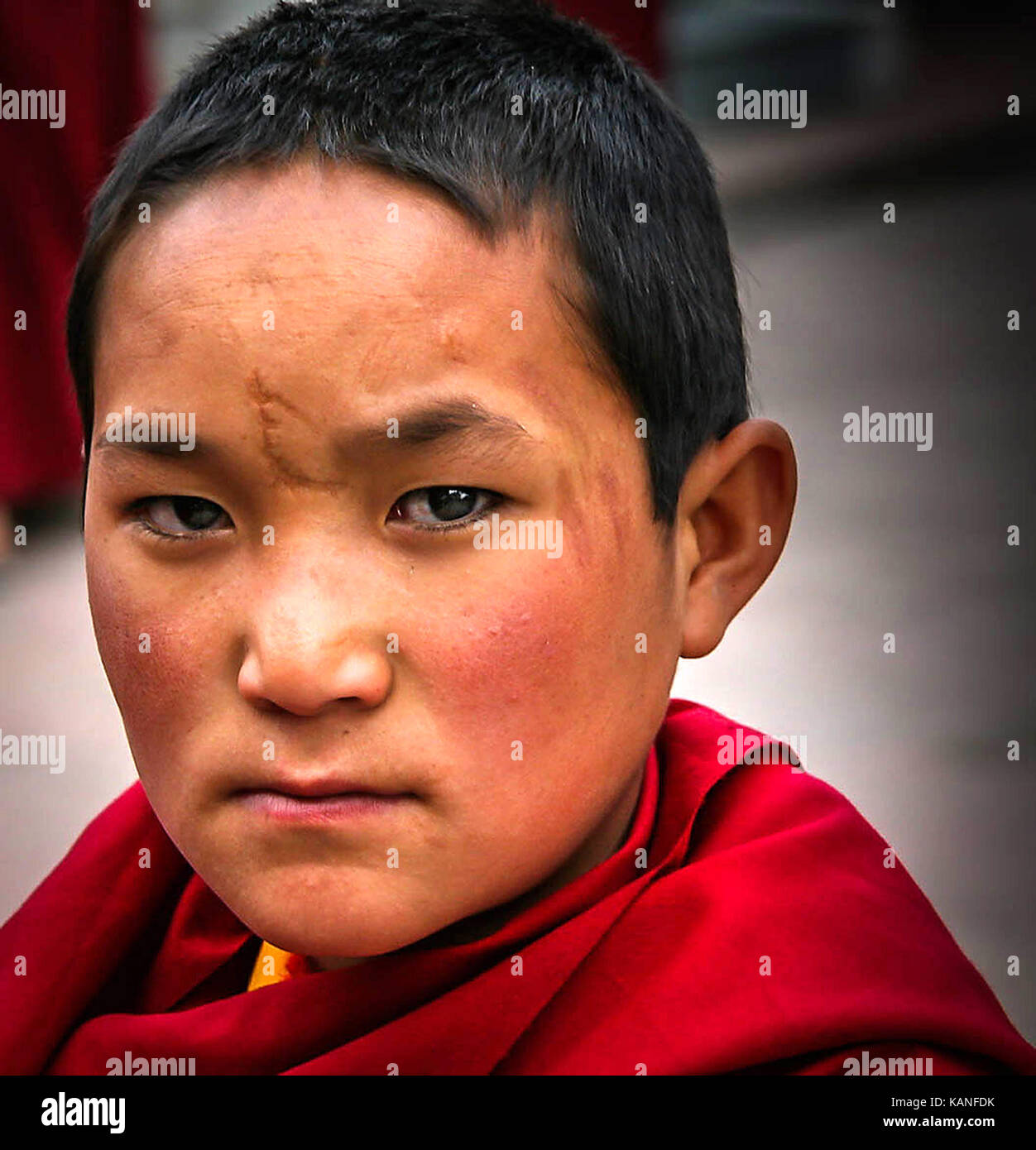 Serious looking young Buddhist Monk with scars Stock Photo Alamy