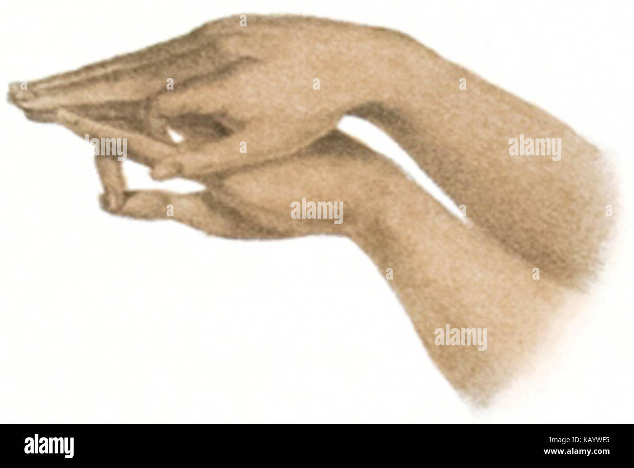 Фига из пальцев. На внутреннем своде стопы 2 косточки. Фиг 4. Фиг 4. Инструкция о использованию манжеты.