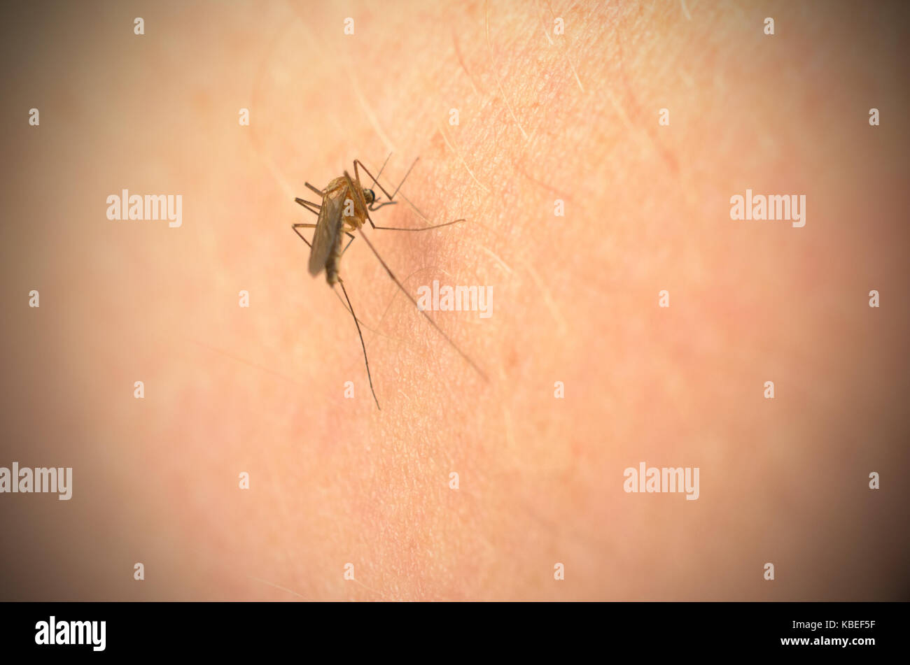 Mosquito bites hires stock photography and images Alamy