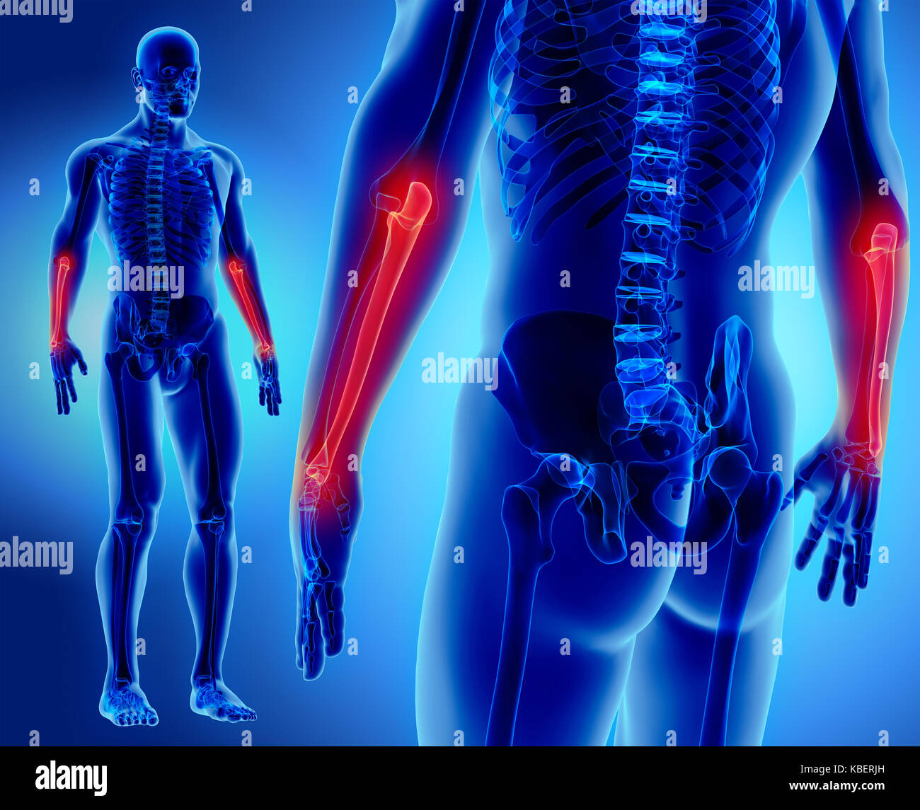 3D illustration of Ulna Part of Human Skeleton Stock Photo Alamy