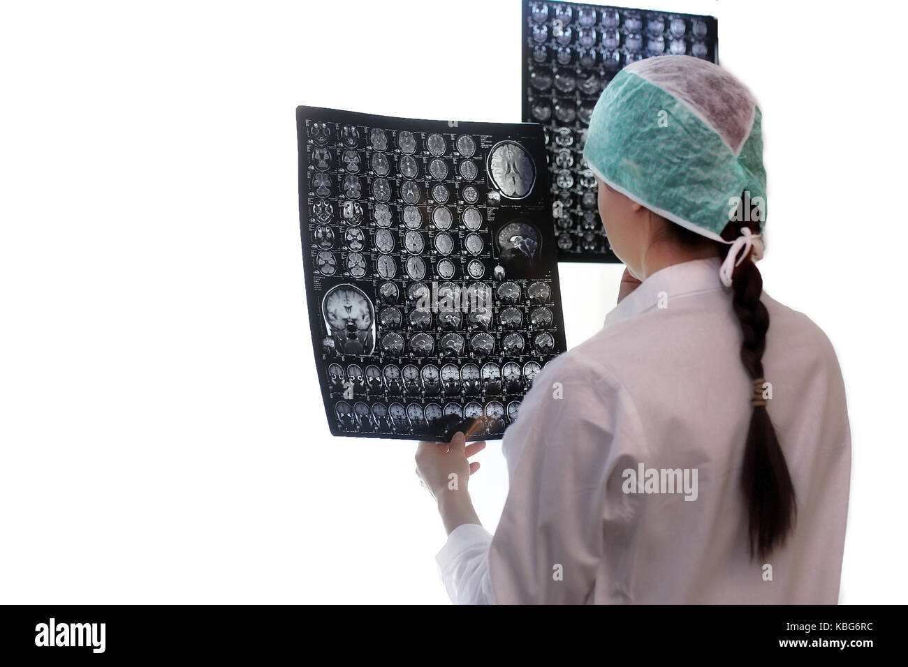 Doctor holding a picture of a brain MRI Stock Photo - Alamy