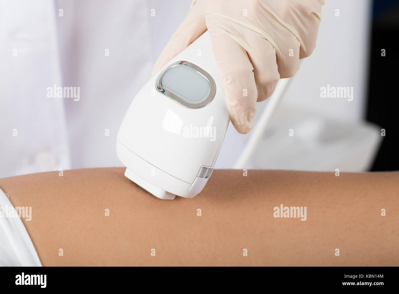 Close-up Of Beautician Giving Epilation Laser Treatment On Woman's Leg Stock Photo