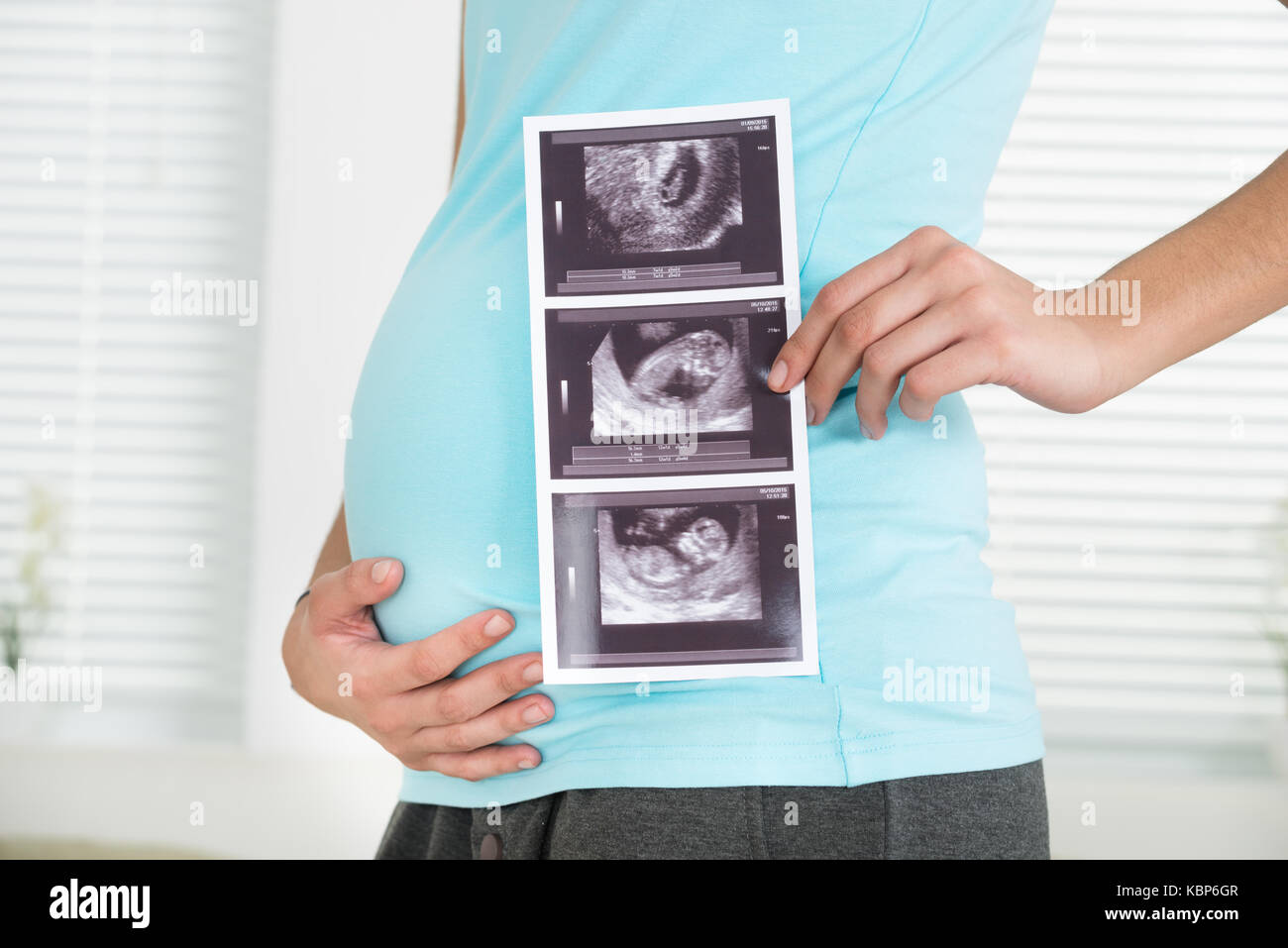 Side view midsection of pregnant woman holding ultrasound scan at home Stock Photo