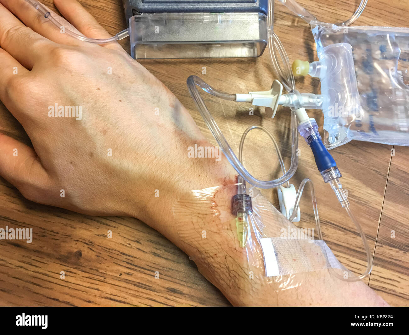 Infusion Stock Photo - Alamy