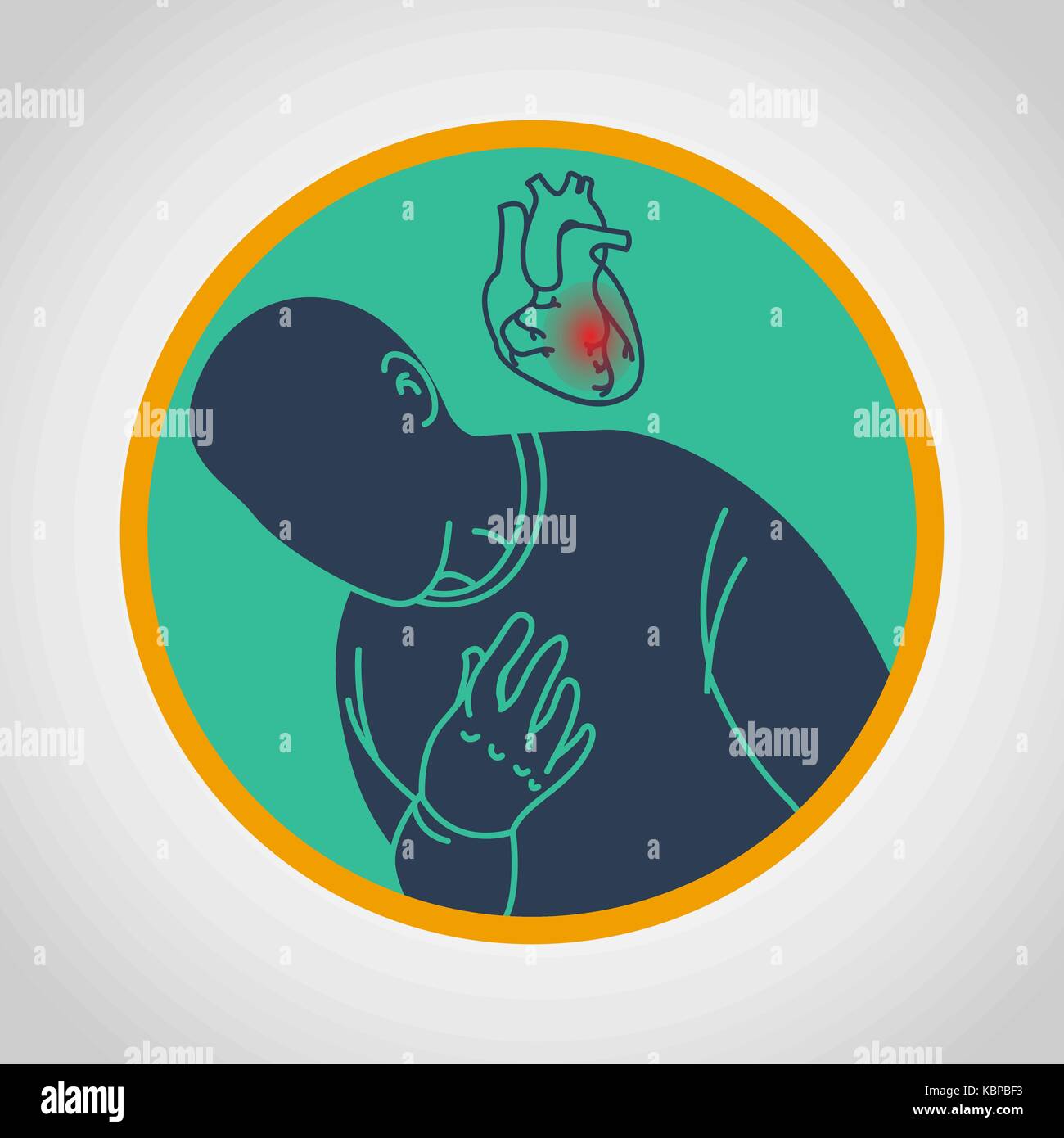 Coronary bypass surgery illustration Stock Vector Images - Alamy