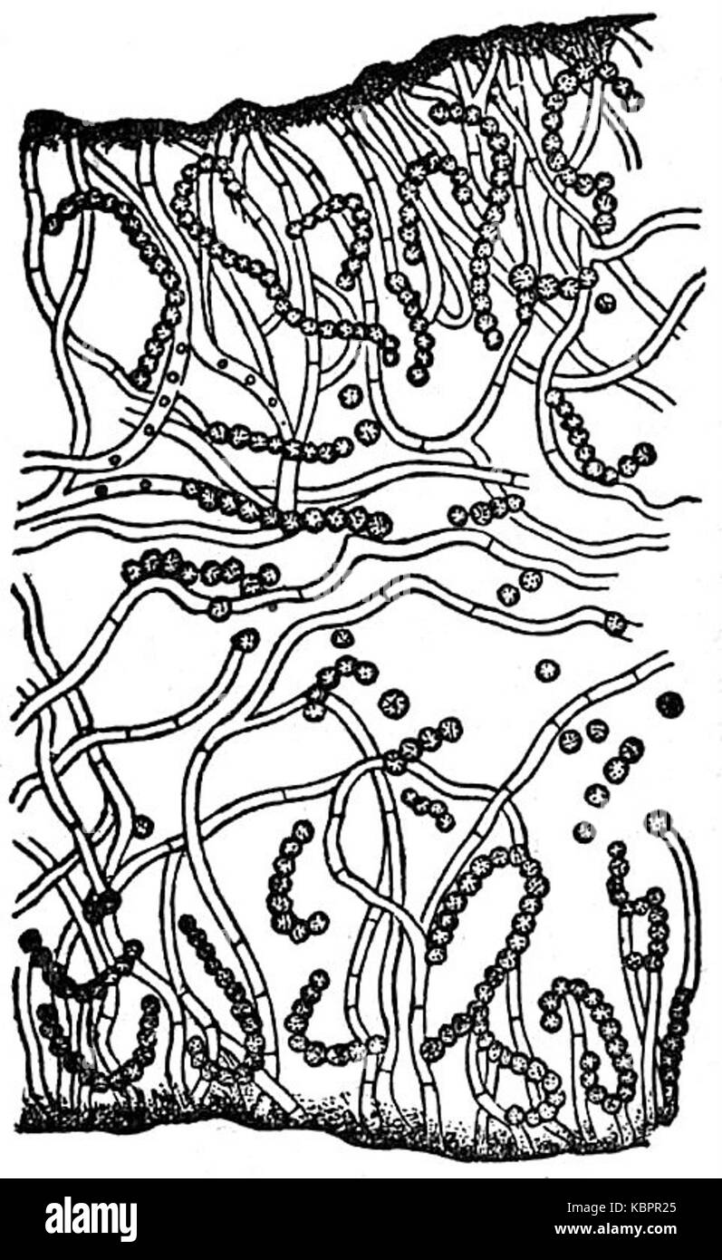 EB1911 Lichens   Collema conglomeratum Stock Photo