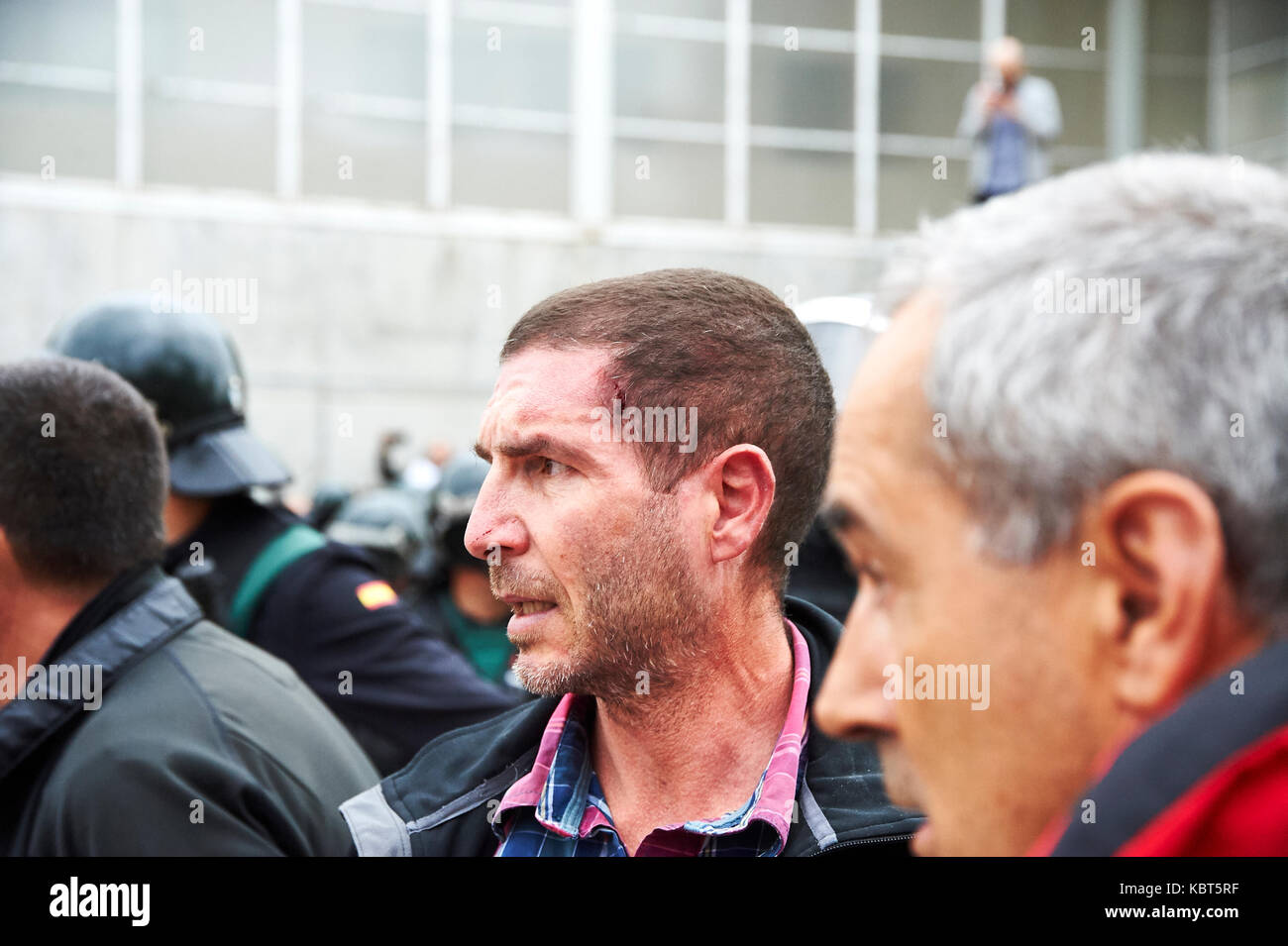 Girona, Spain. 1 October, 2017. A man injured by the Guardia Civil at Sant Julia de Ramis, place of vote of the catalan president Carles Puigdemont. The Guardia Civil charge against the people impeding that makes a vote. The referendum has been deemed illegal by the Spanish government in Madrid Credit: Pablo Guillen/Alamy Live News Stock Photo