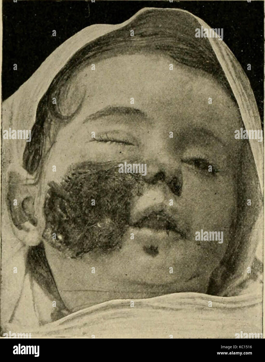 'The diseases of infants and children' (1919) Stock Photo