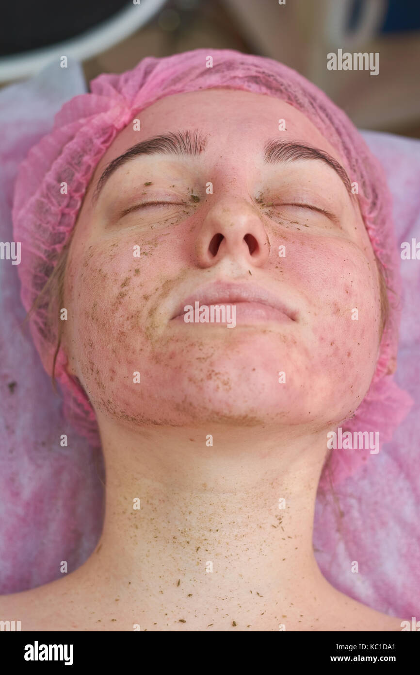 Skin after facial mask. Stock Photo