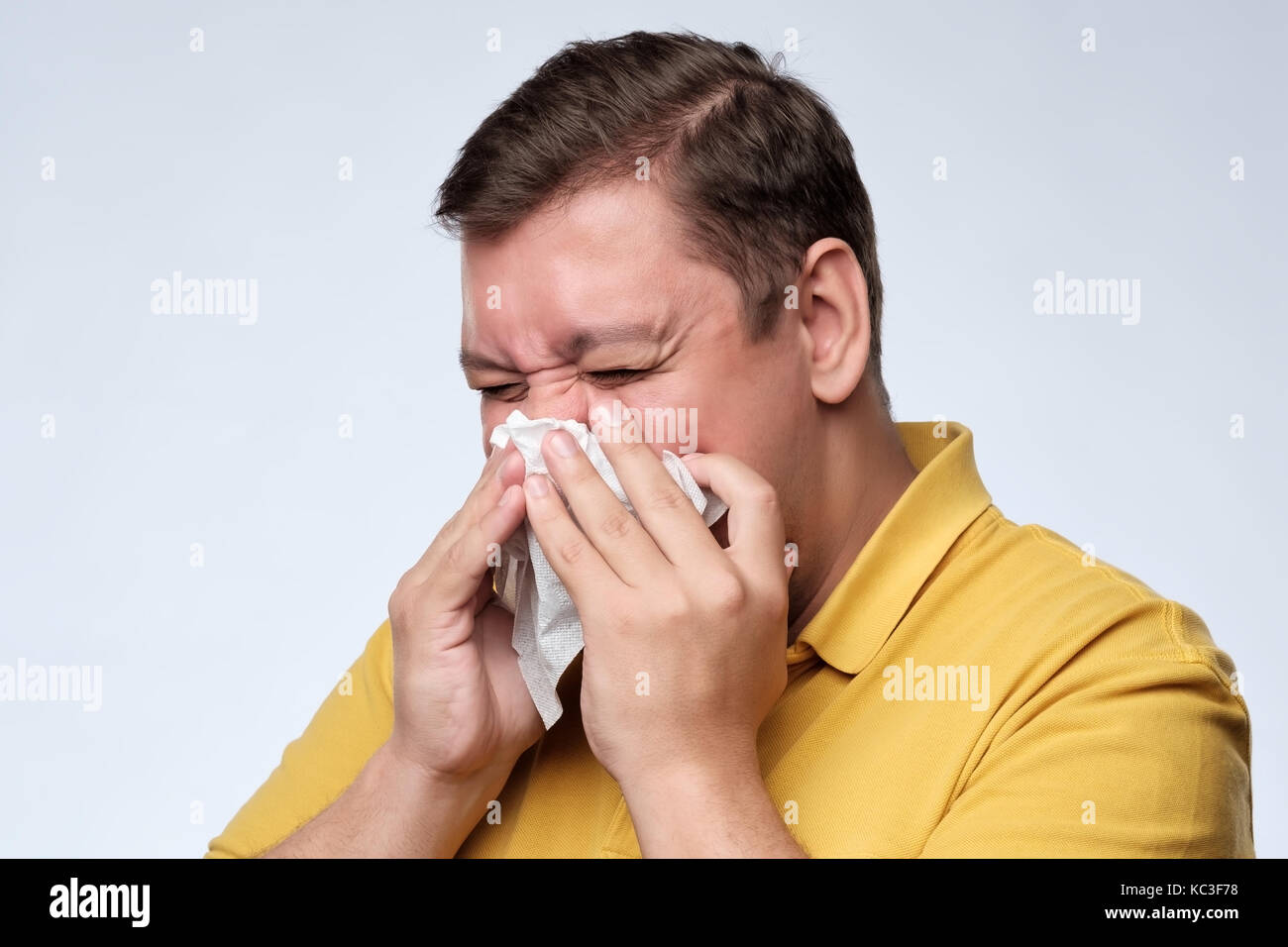 Mature fat caucasian man is ill from colds or pneumonia, sneezing in napkin. Stock Photo
