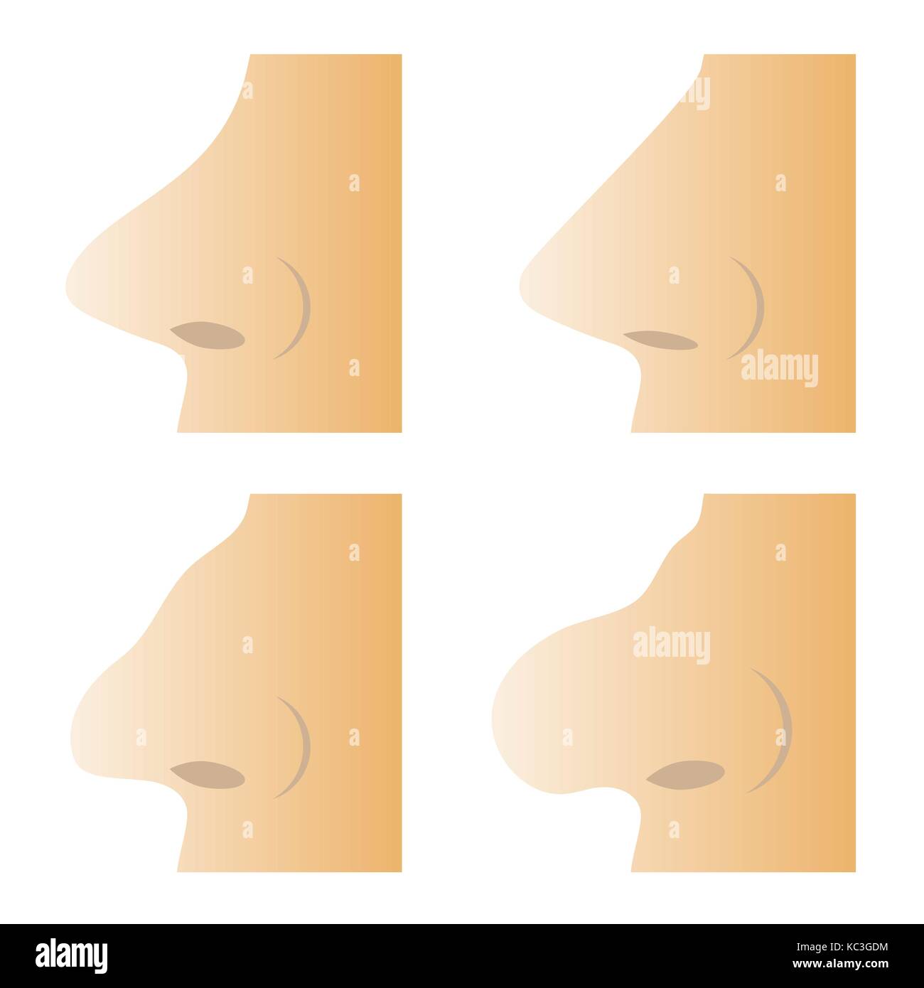 nose types chart