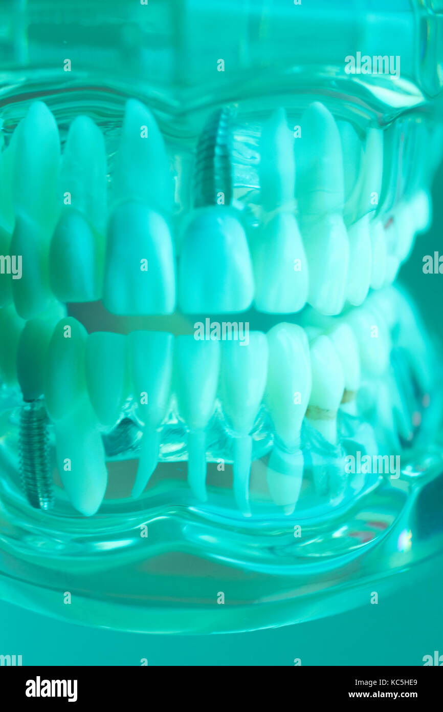 Dental teeth mouth dentists teaching model with teeth, gums, molars and wisdom tooth. Stock Photo