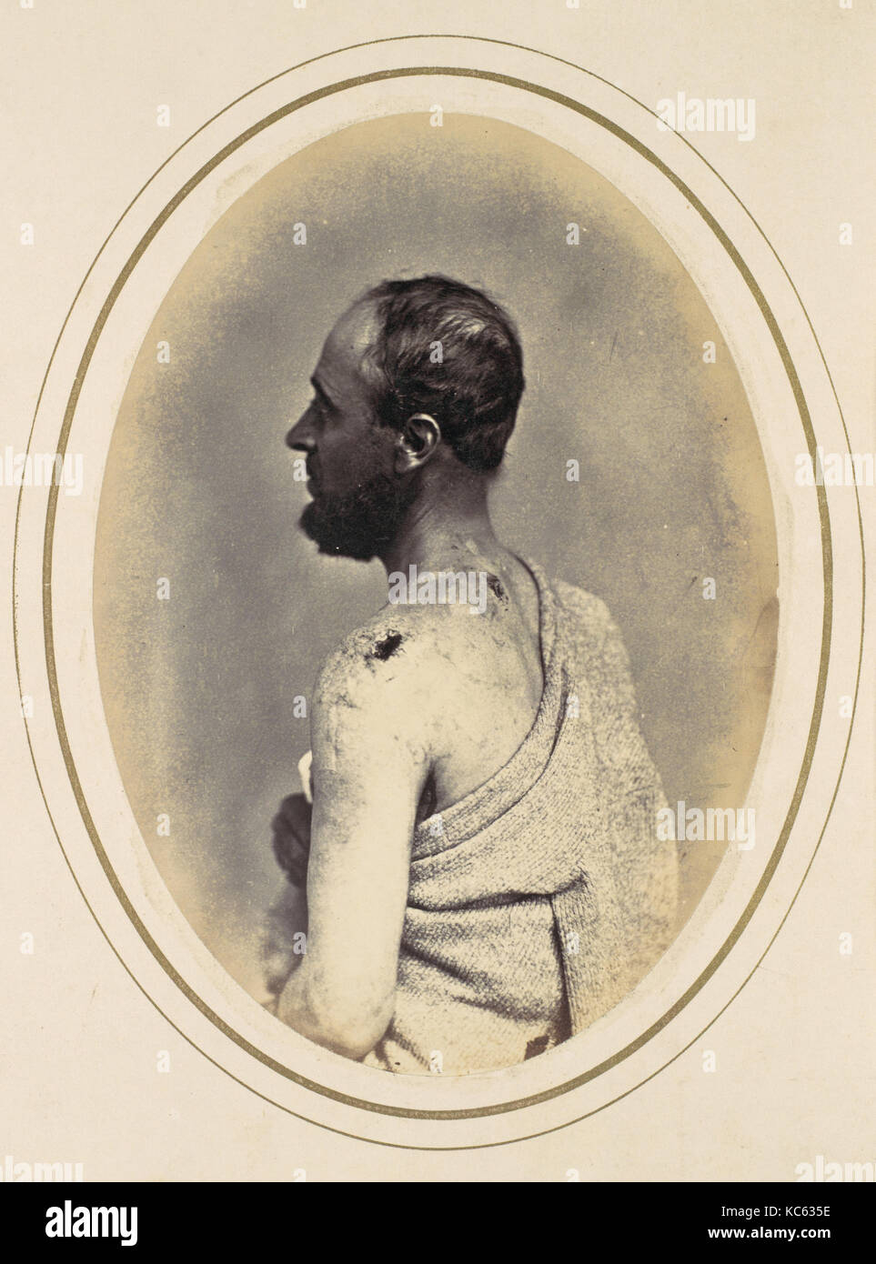 Henry Yon, 1865, Albumen silver print from glass negative, Photographs