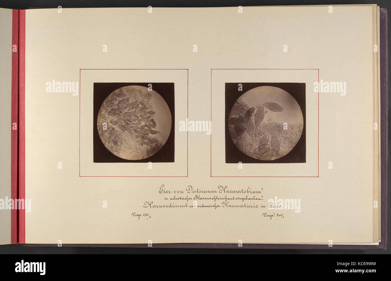 Mikroskopisch-Photographischer Atlas der Harnsedimente, Robert Ultzmann, 1869 Stock Photo