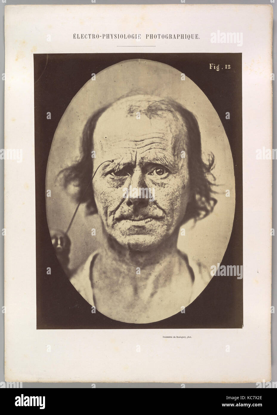 Figure 12 A Study Of The Contraction Of And The Expression Produced By