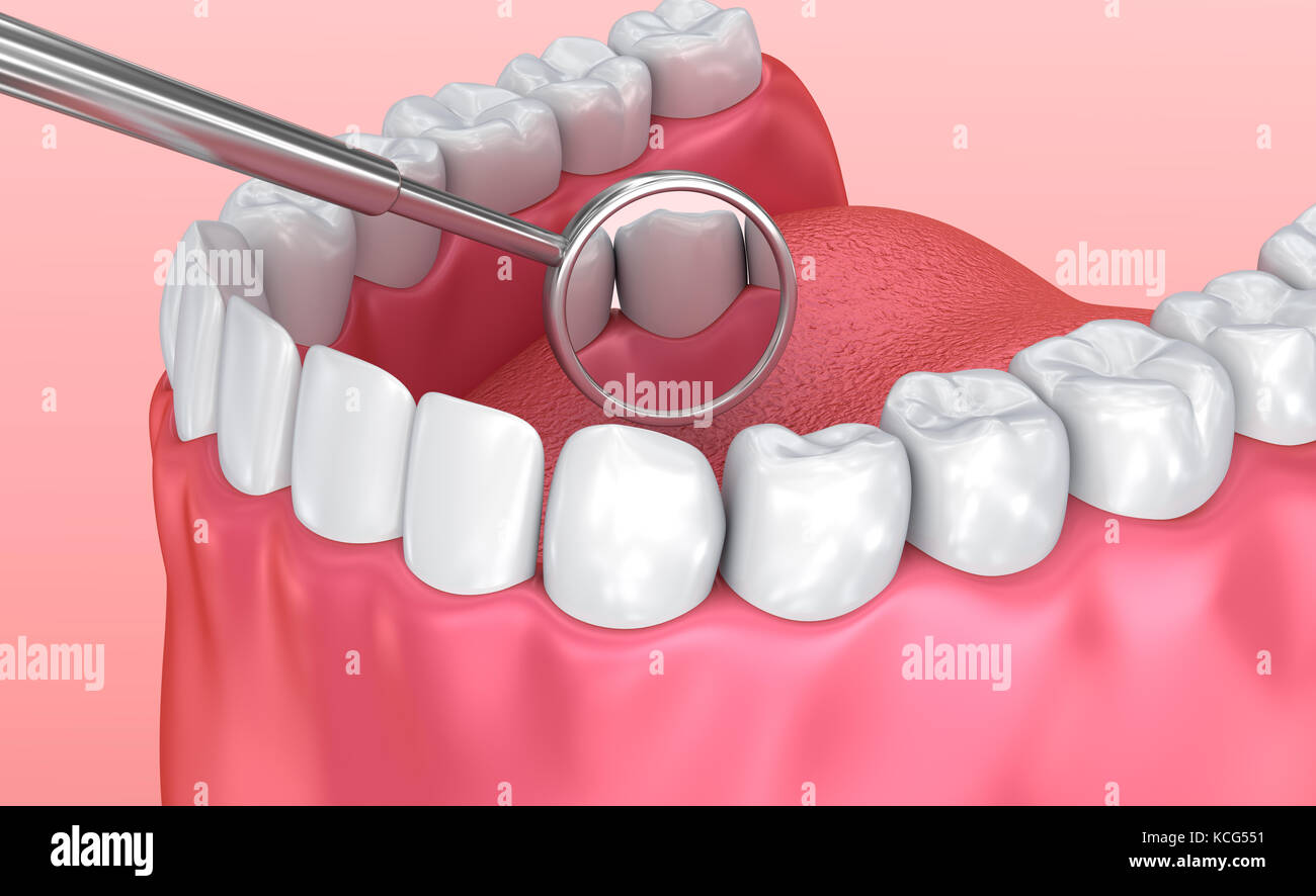 Teeth inspection with mirror. Medically accurate tooth 3D illustration Stock Photo