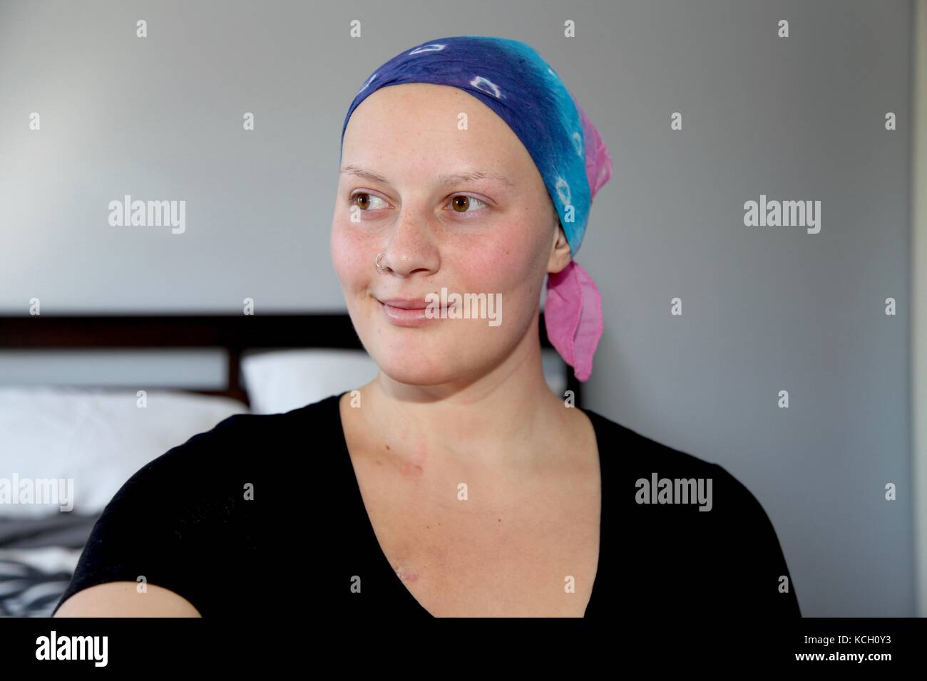 Young cancer patient in a headscarf Stock Photo