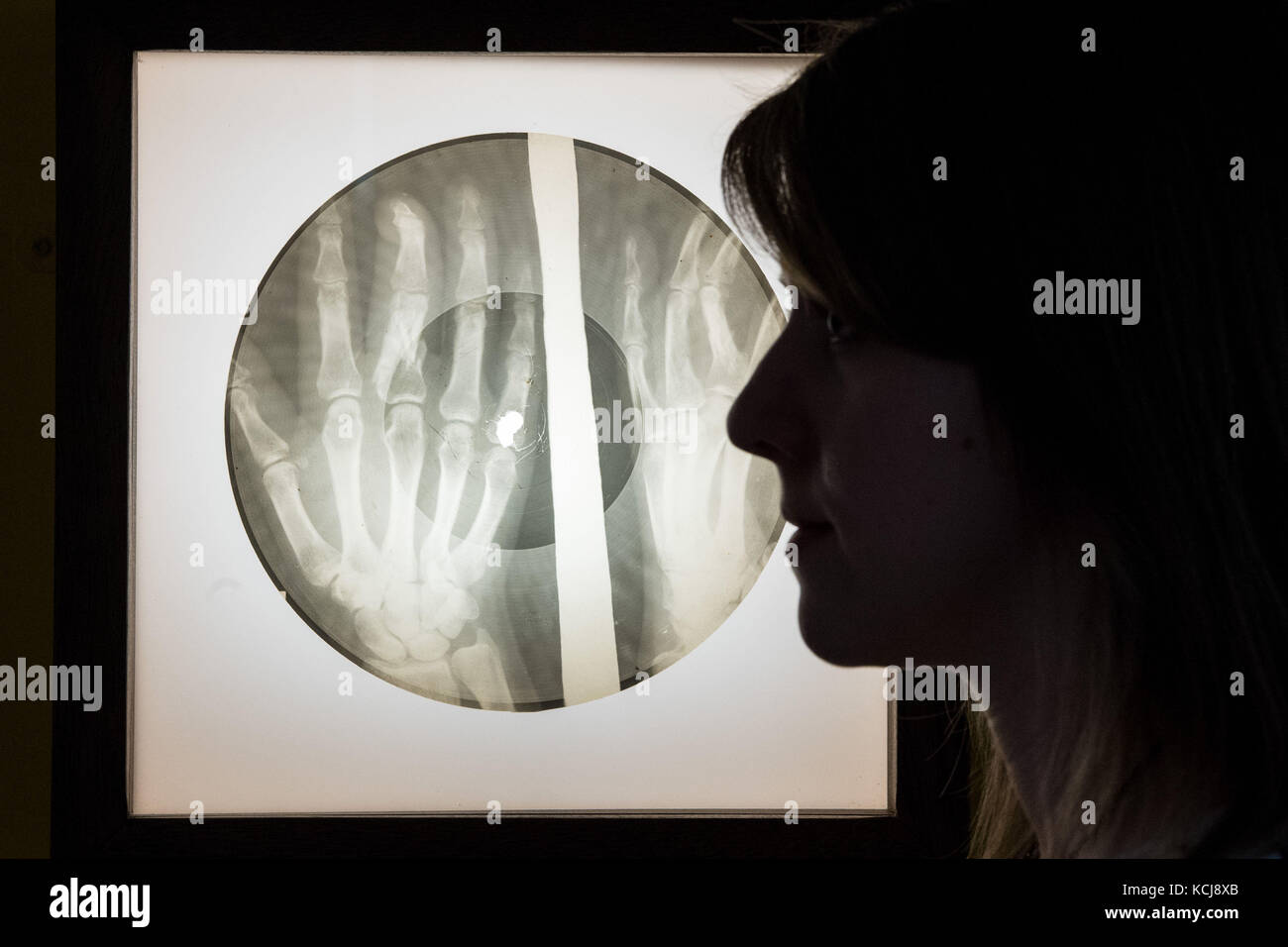 Early x ray hires stock photography and images Alamy