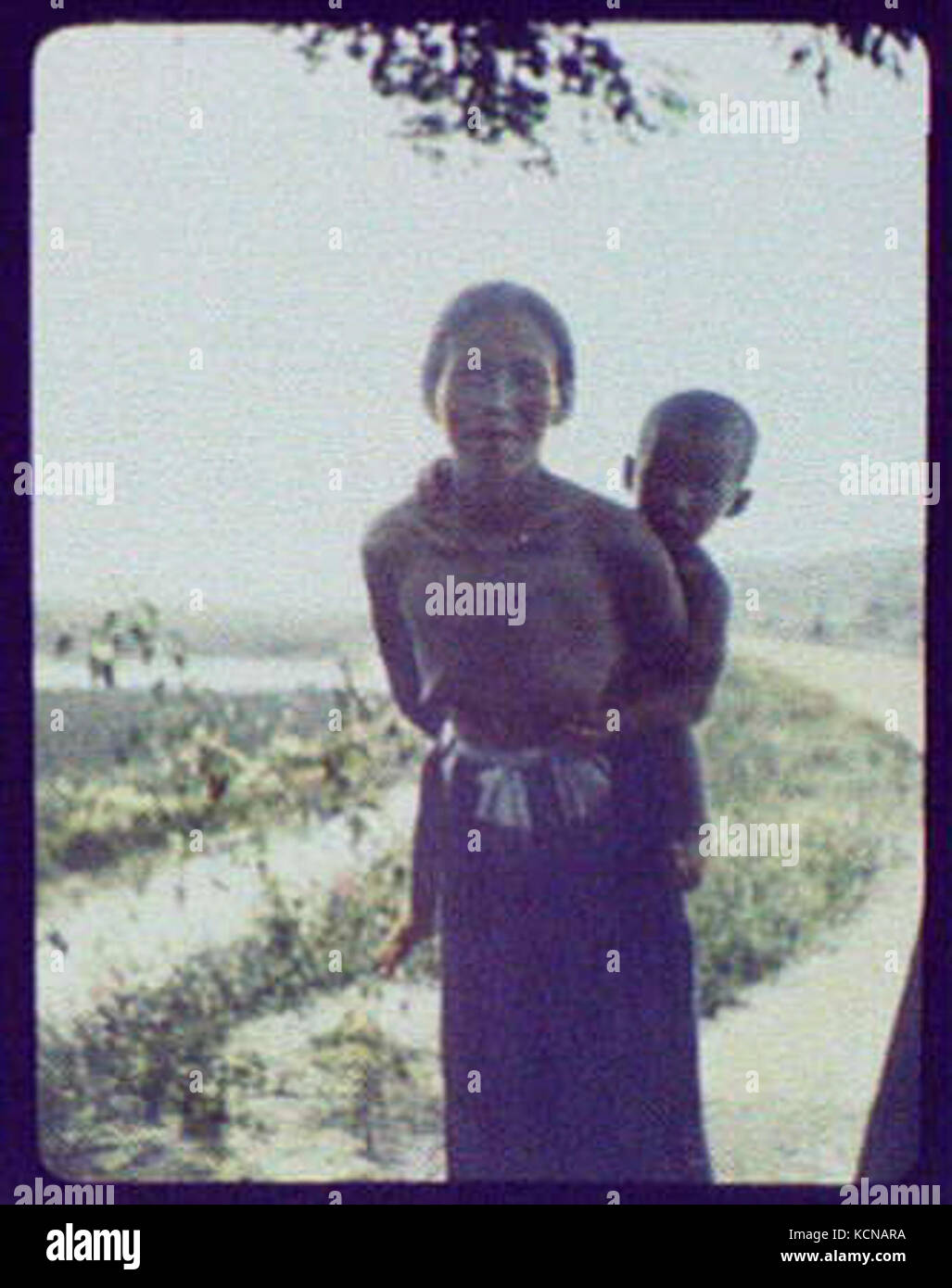bare breasted mothers Burning pain the the breast