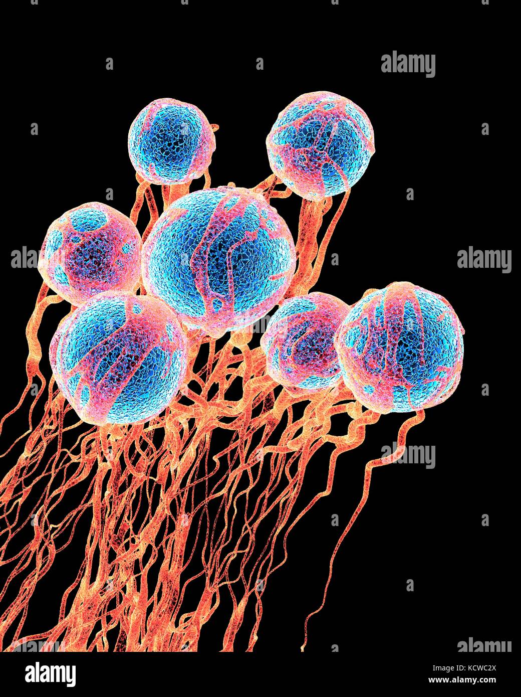 Cancer cells. Computer illustration of cancer cells, showing the blood vessel formation providing the the cells with oxygens and nutrigens. The cells with their nuclei are shown in blue. Stock Photo