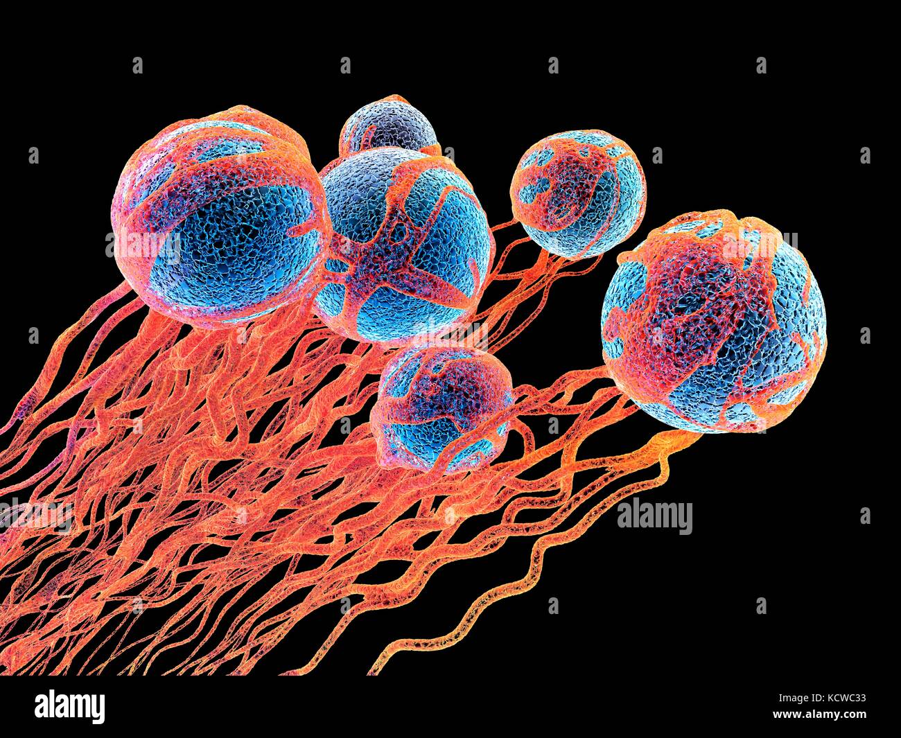 Cancer cells. Computer illustration of cancer cells, showing the blood vessel formation providing the the cells with oxygens and nutrigens. The cells with their nuclei are shown in blue. Stock Photo