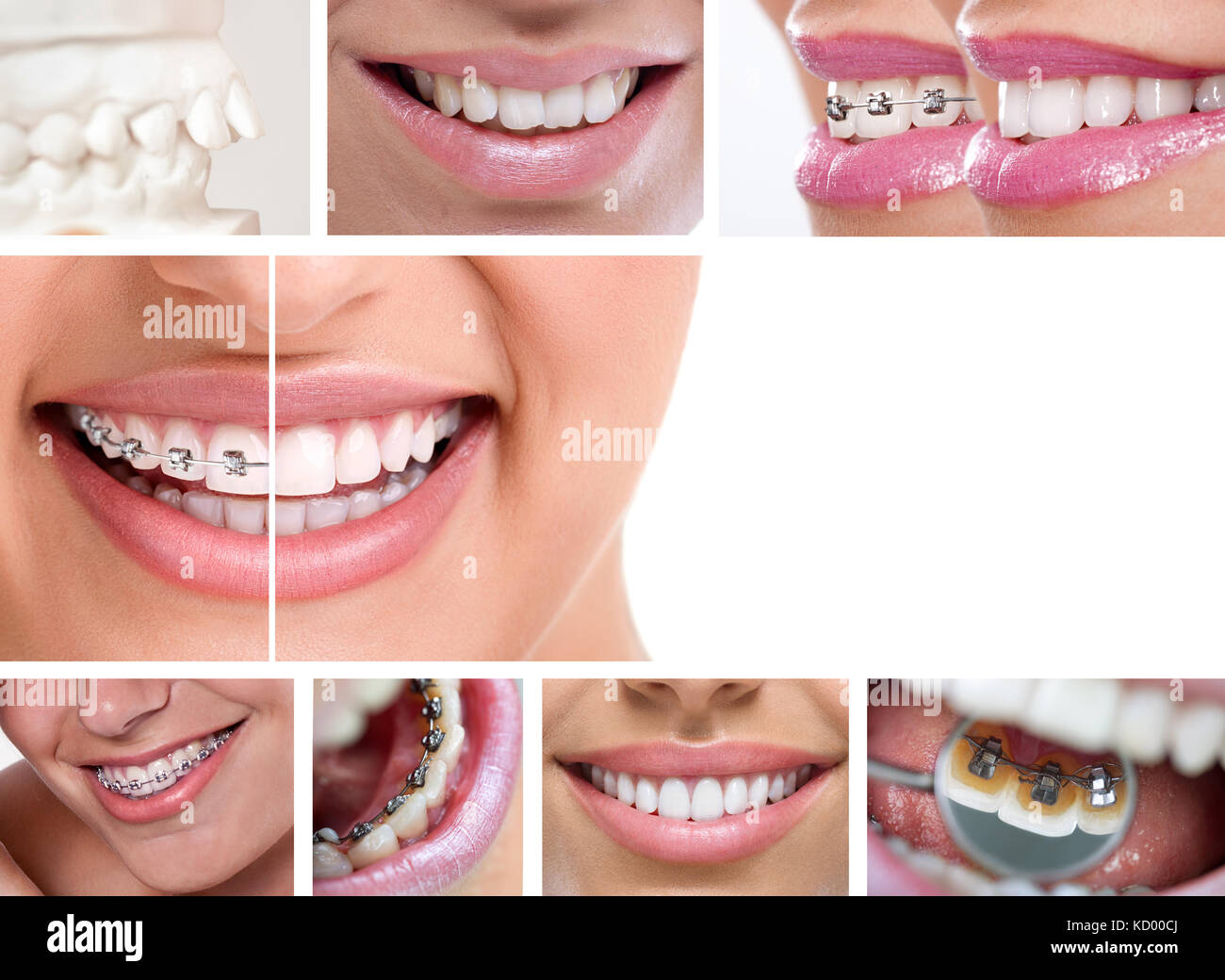 Impacted teeth hires stock photography and images Alamy