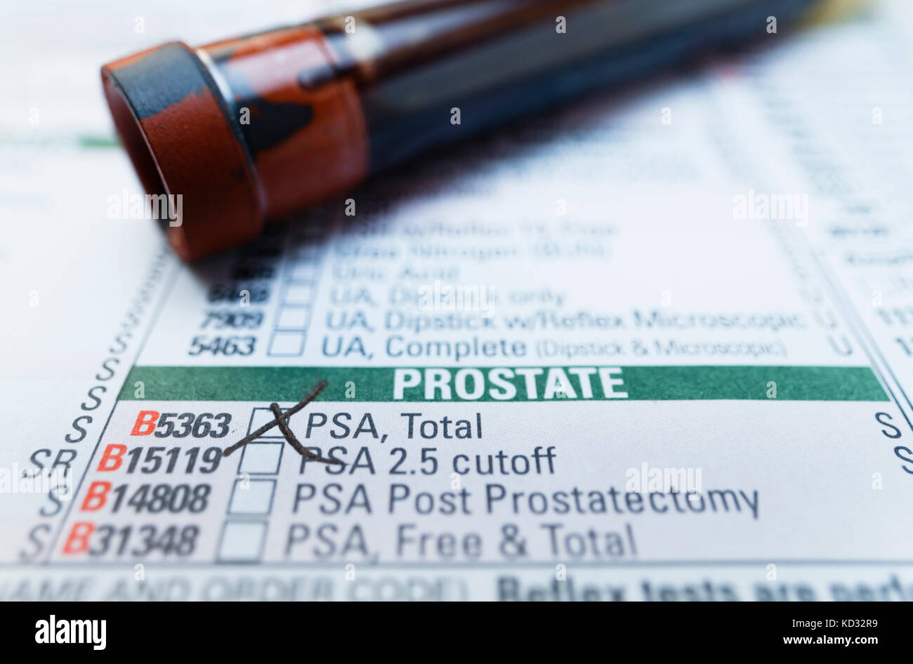 Prostate specific antigen test hires stock photography and images Alamy